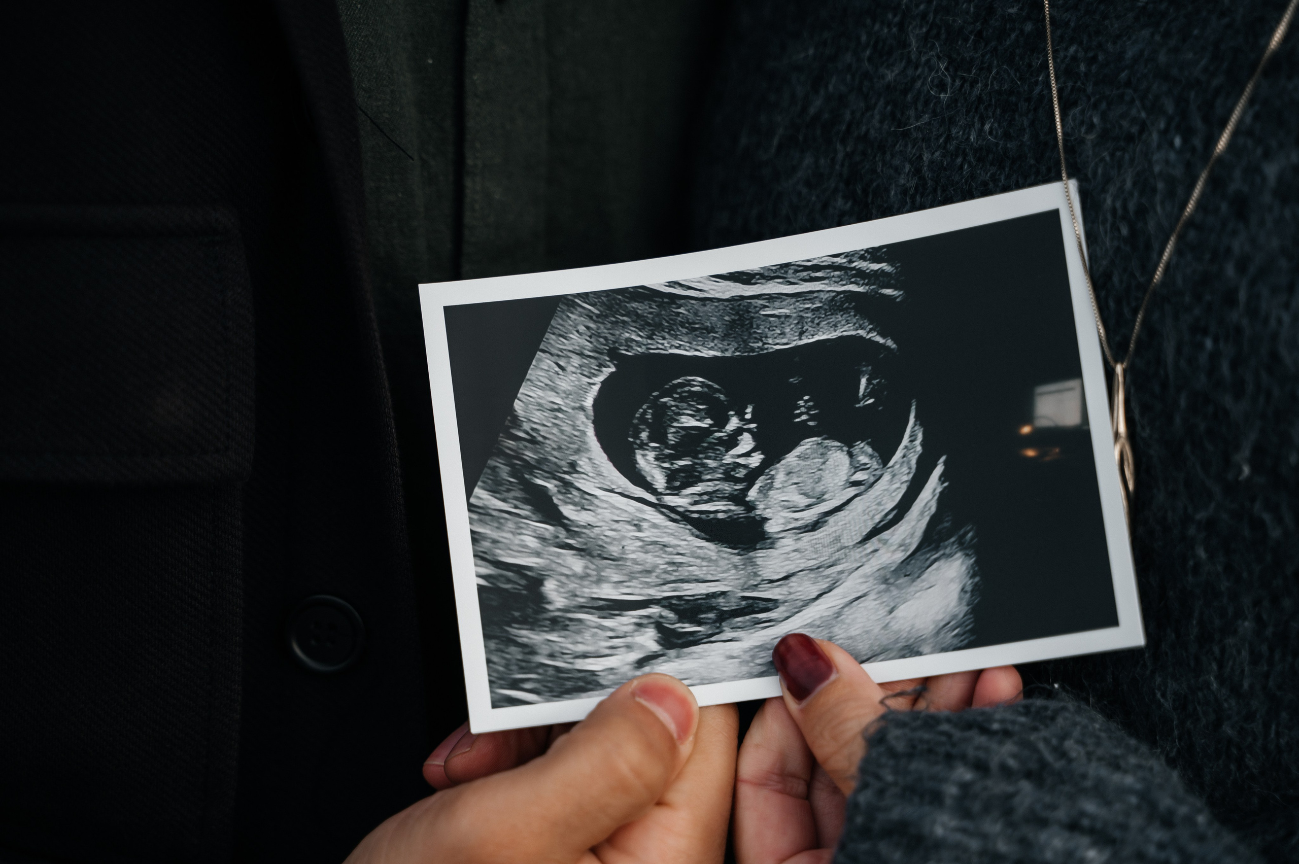 Parfotografering på Skrea strand | Fotograf i Falkenberg. Bröllops- och familjefotograf i Halmstad | Valentina