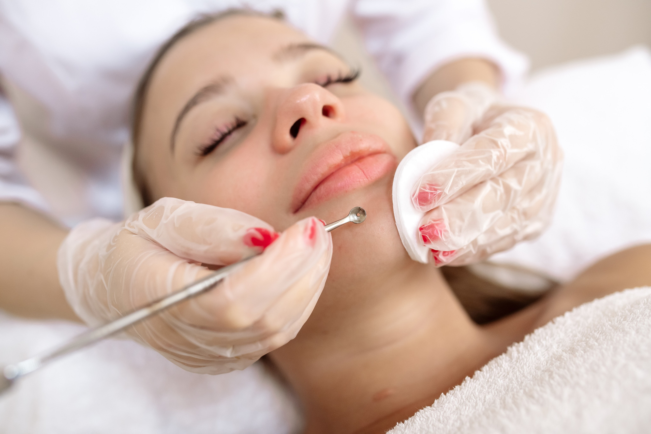 Врач-косметолог. Фотограф Мария Стрелкова