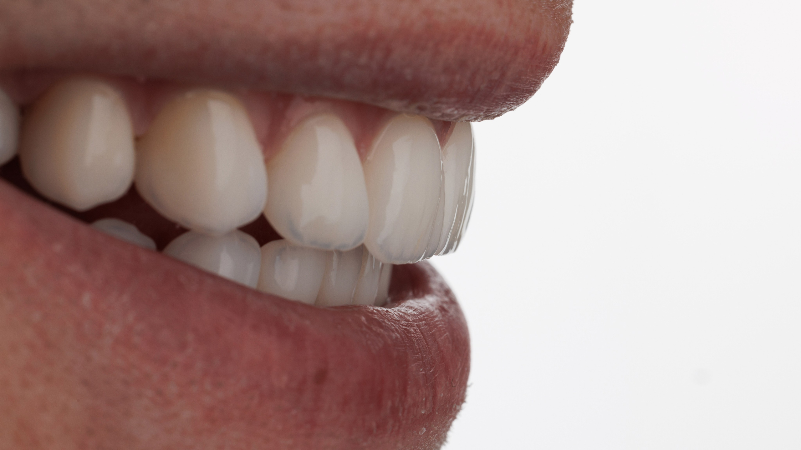 Ортопедия. Дентал фотограф — видеограф Денис Дорошенко