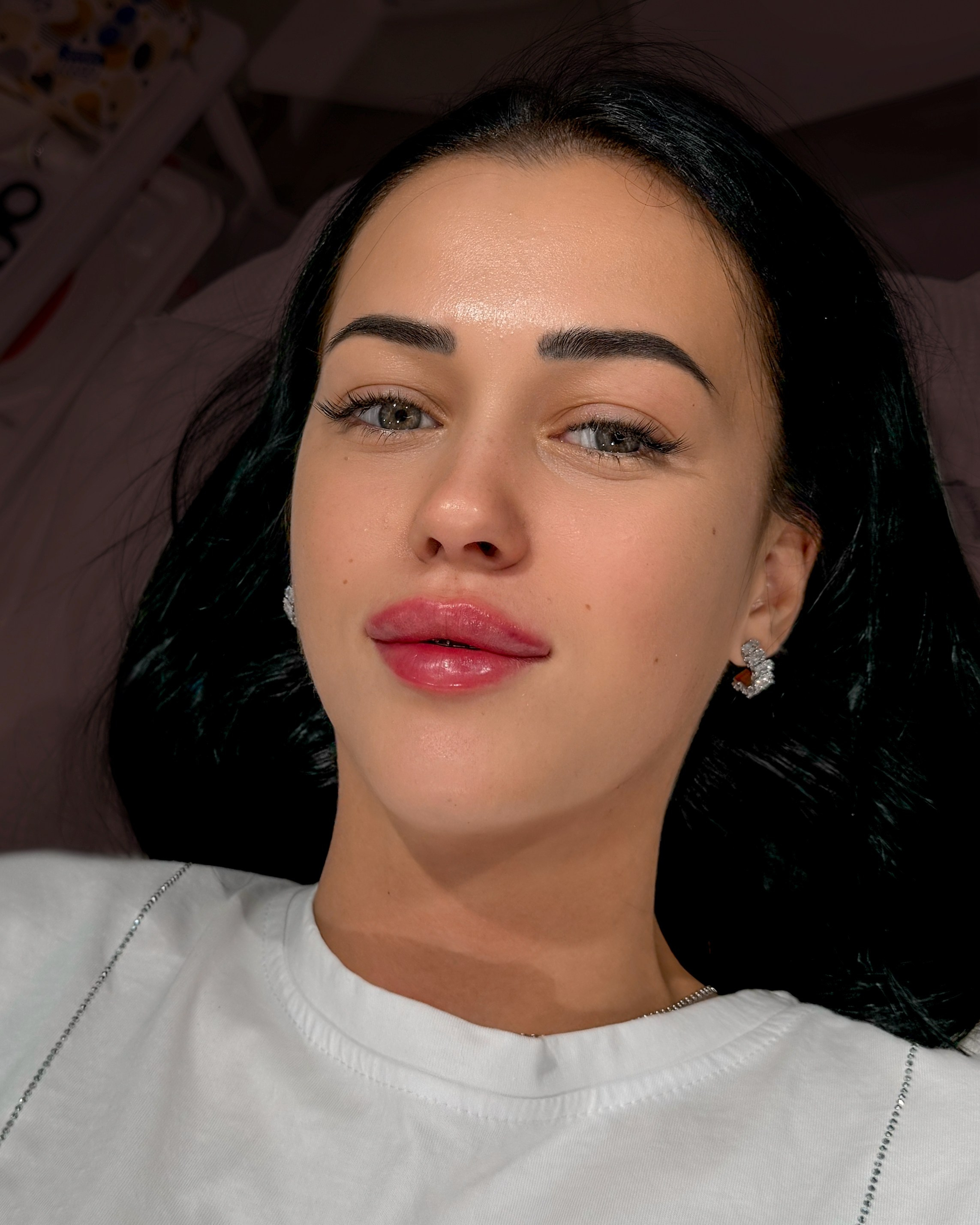 Инъекционная косметология. Студия перманентного макияжа, косметологии и массажа SYMMETRY в Москве, м. Киевская