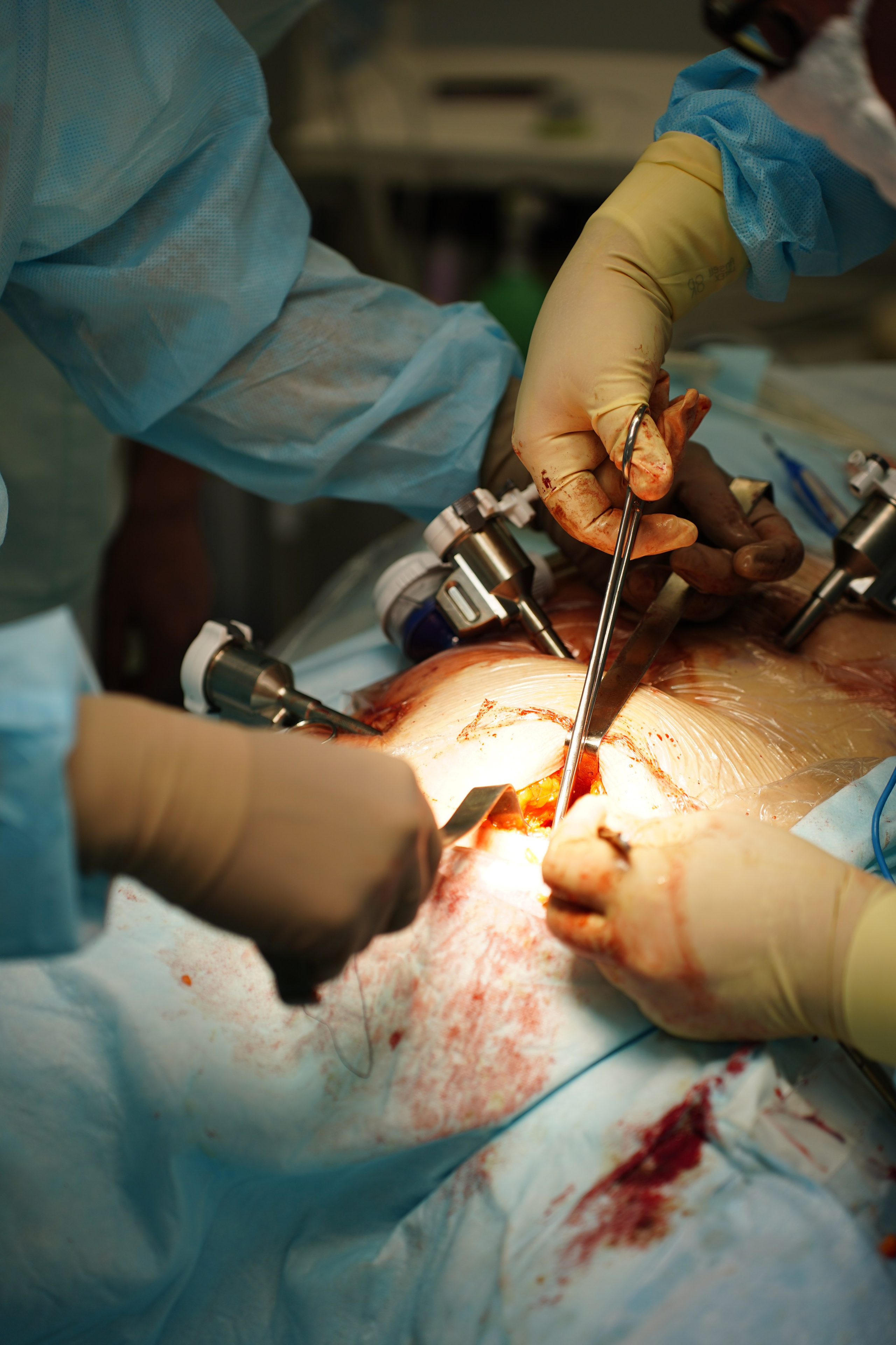 II Евразийский форум Колоректальной Хирурги EFCS. Pupov.png