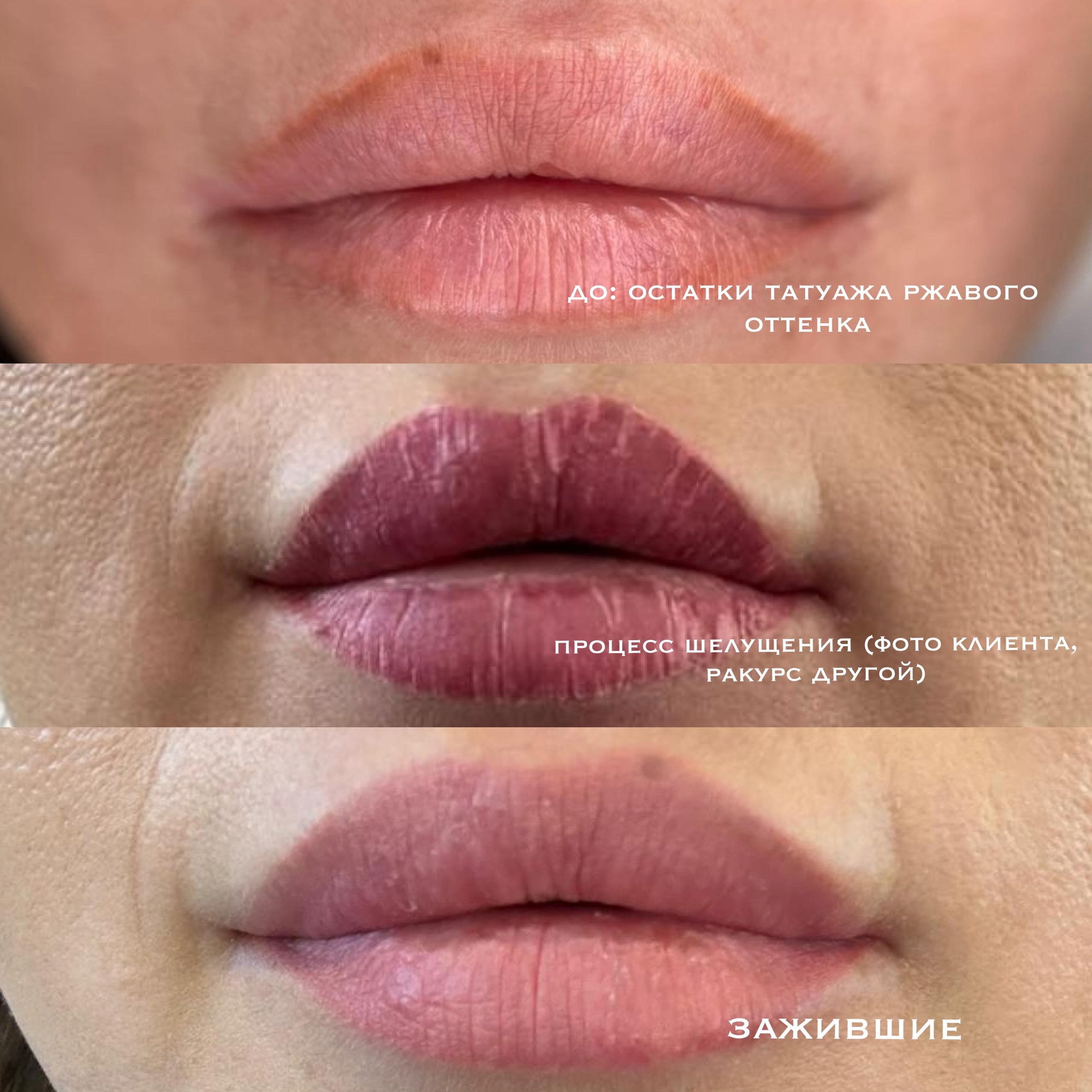 ГУБЫ зажившие. Перманентный макияж и удаление старого татуажа в Ростове-на-Дону Дарья Исакова