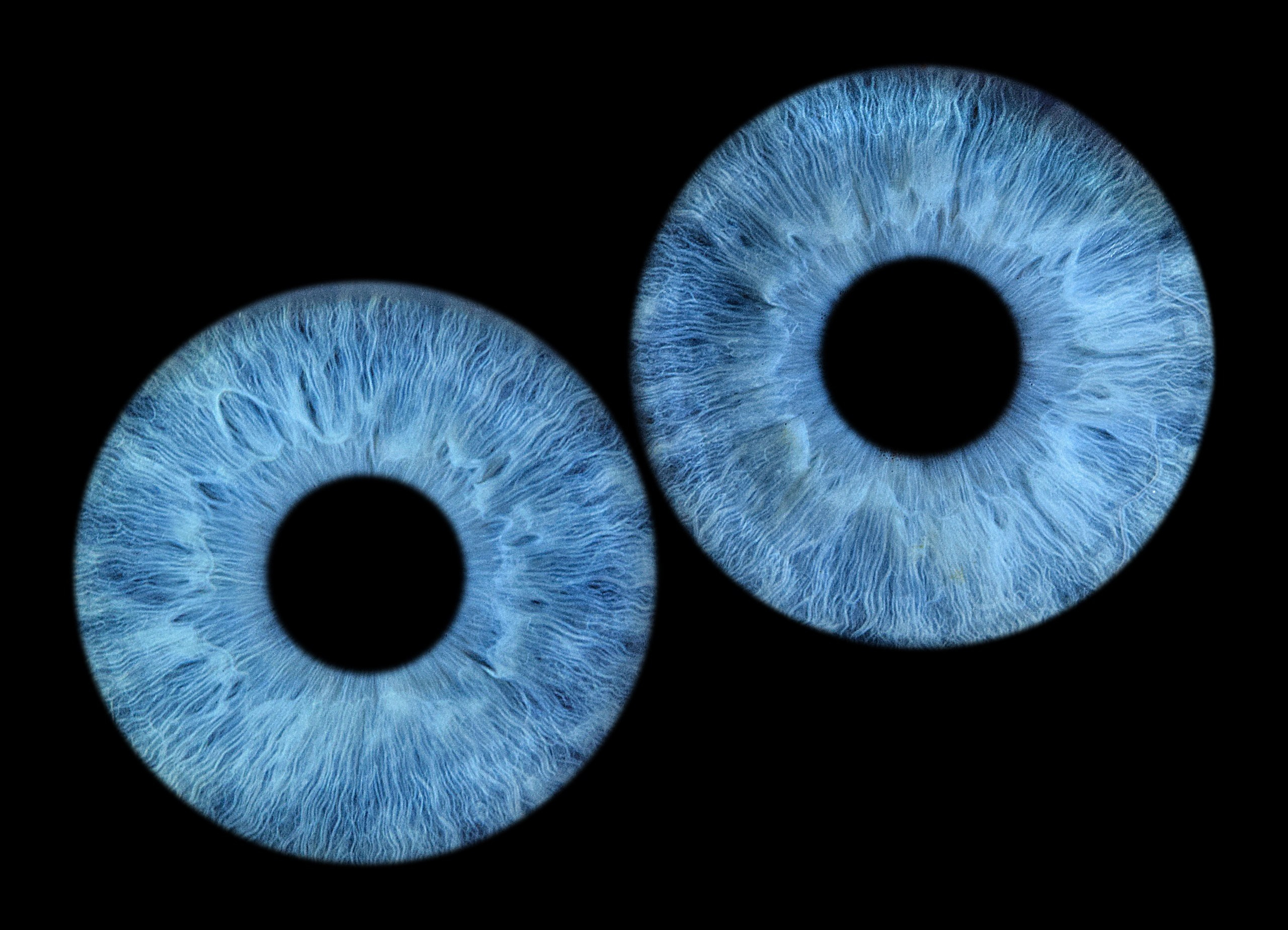 Портфолио. EYEtob | Фотография радужной оболочки | Тобольск