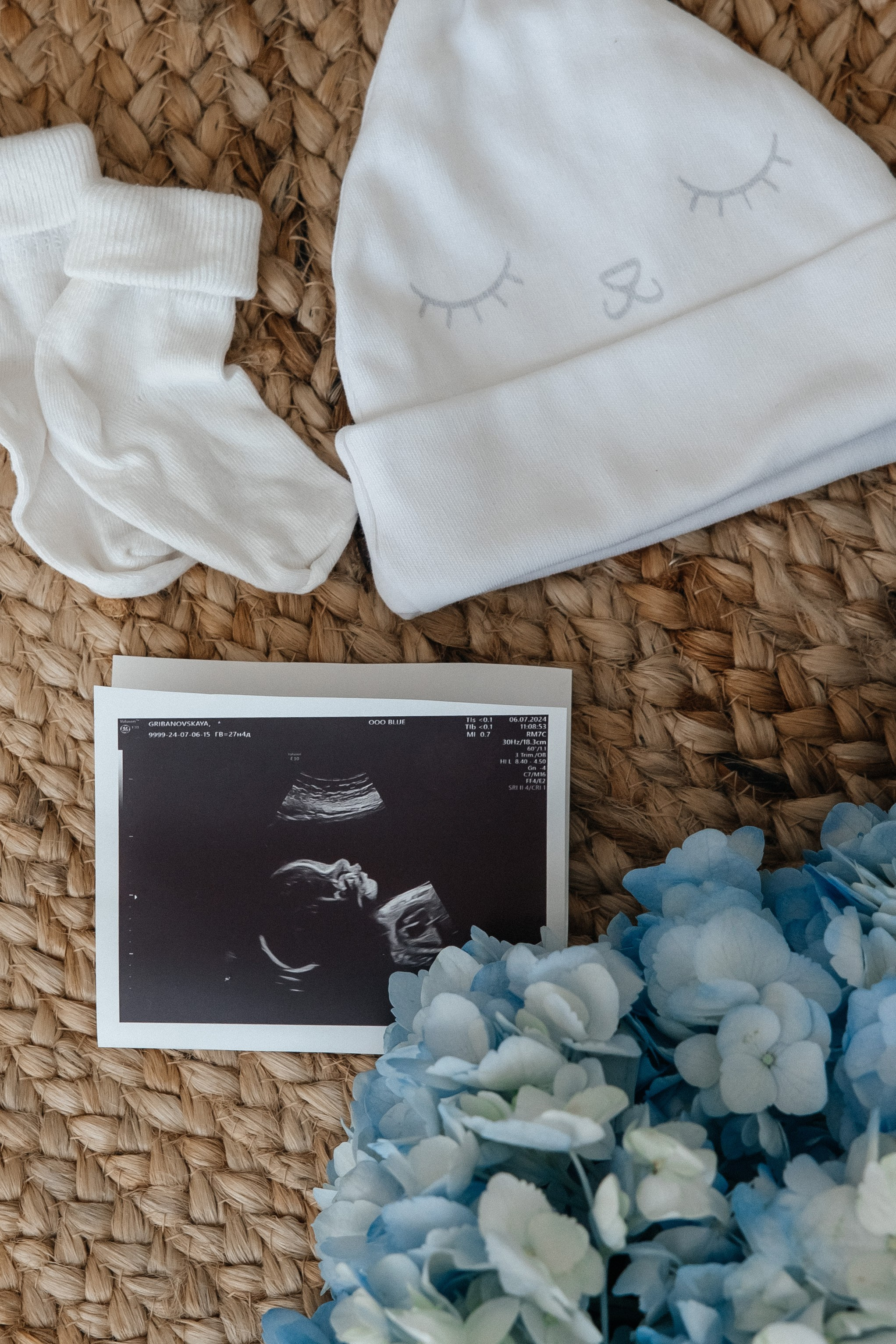 Семейная фотосессия Марк & Анна в ожидании чуда. Свадебный и семейный фотограф в Краснодар, Россия