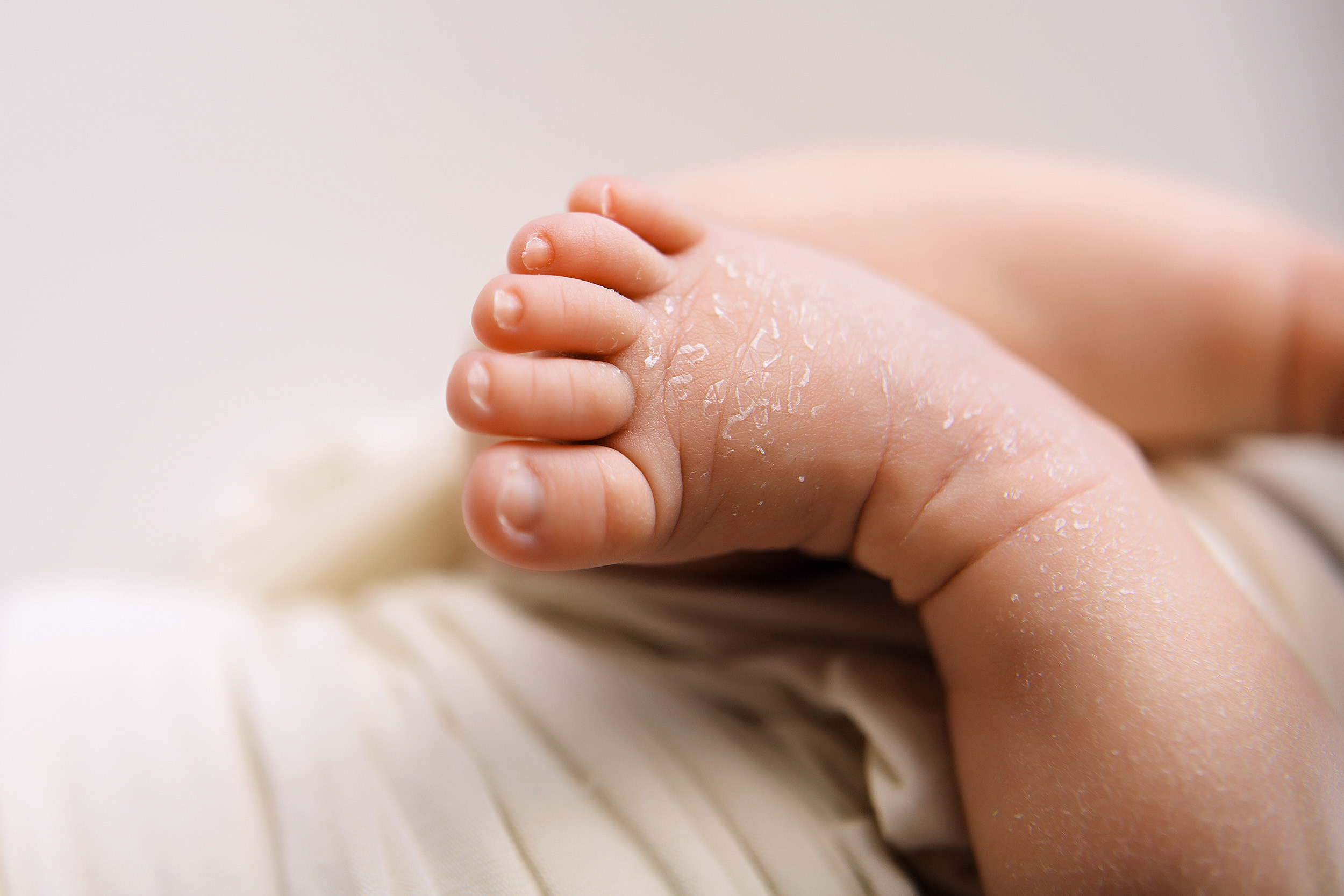 ножки новорожденного с шелушками