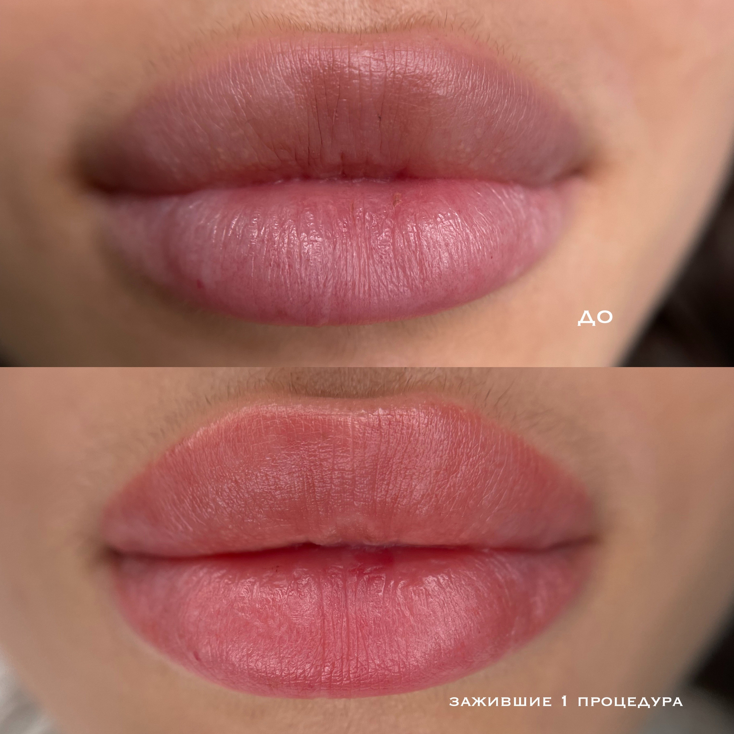ГУБЫ зажившие. Перманентный макияж и удаление старого татуажа в Ростове-на-Дону Дарья Исакова