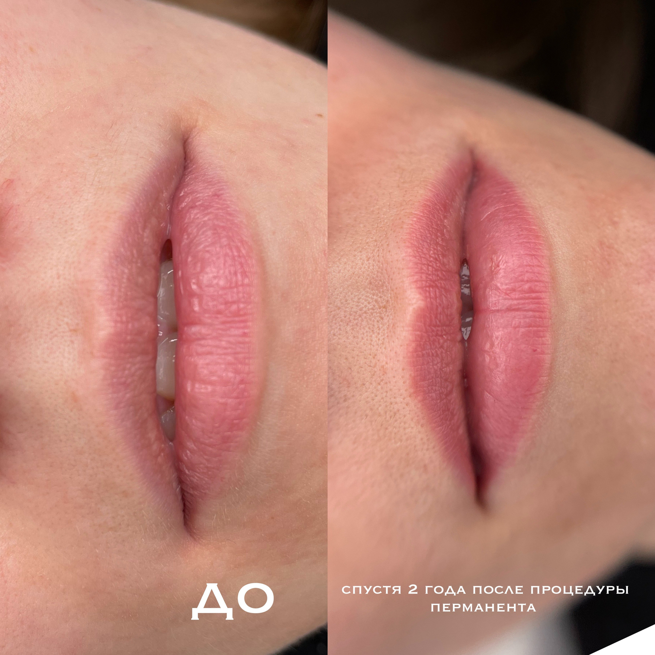 ГУБЫ зажившие. Перманентный макияж и удаление старого татуажа в Ростове-на-Дону Дарья Исакова