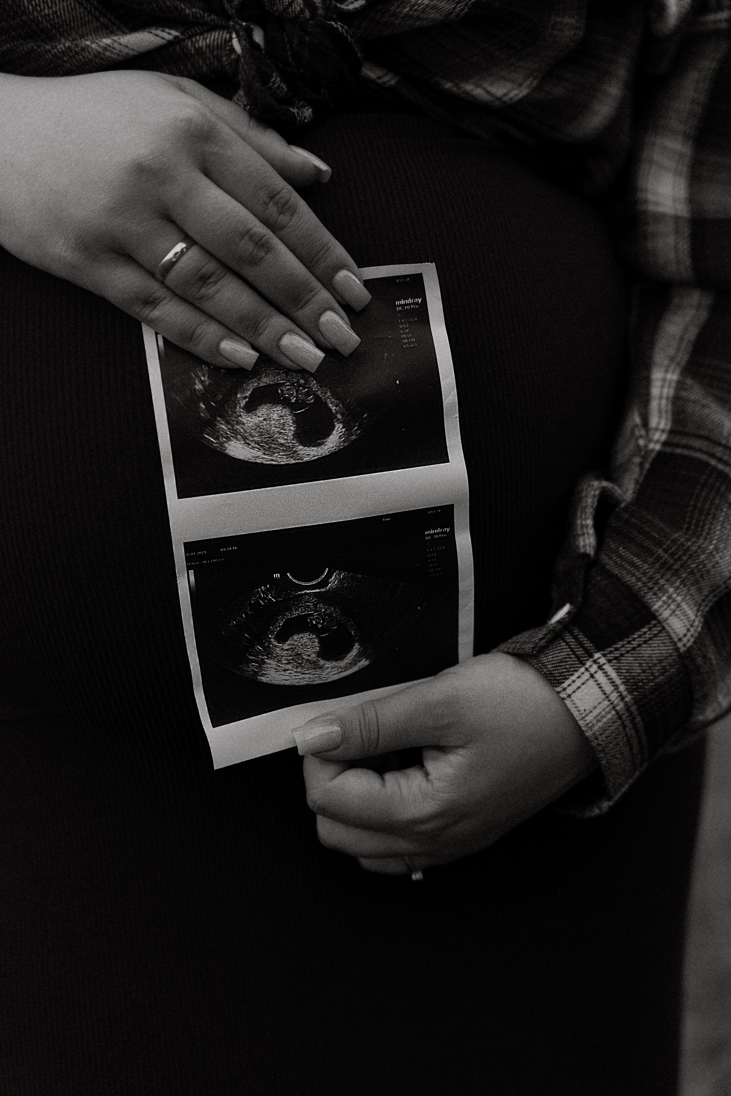 Парная съемка на природе