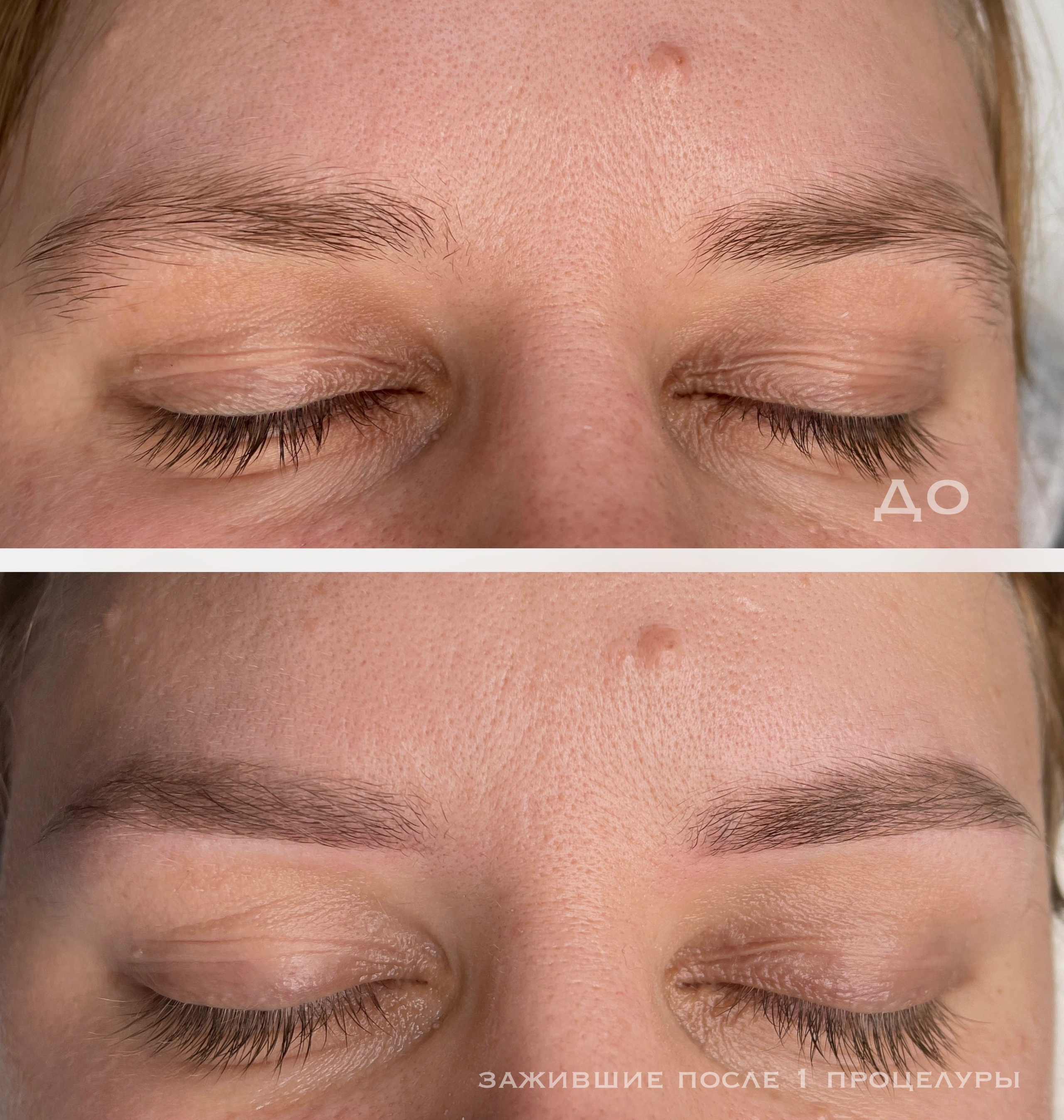 БРОВИ зажившие. Перманентный макияж и удаление старого татуажа в Ростове-на-Дону Дарья Исакова