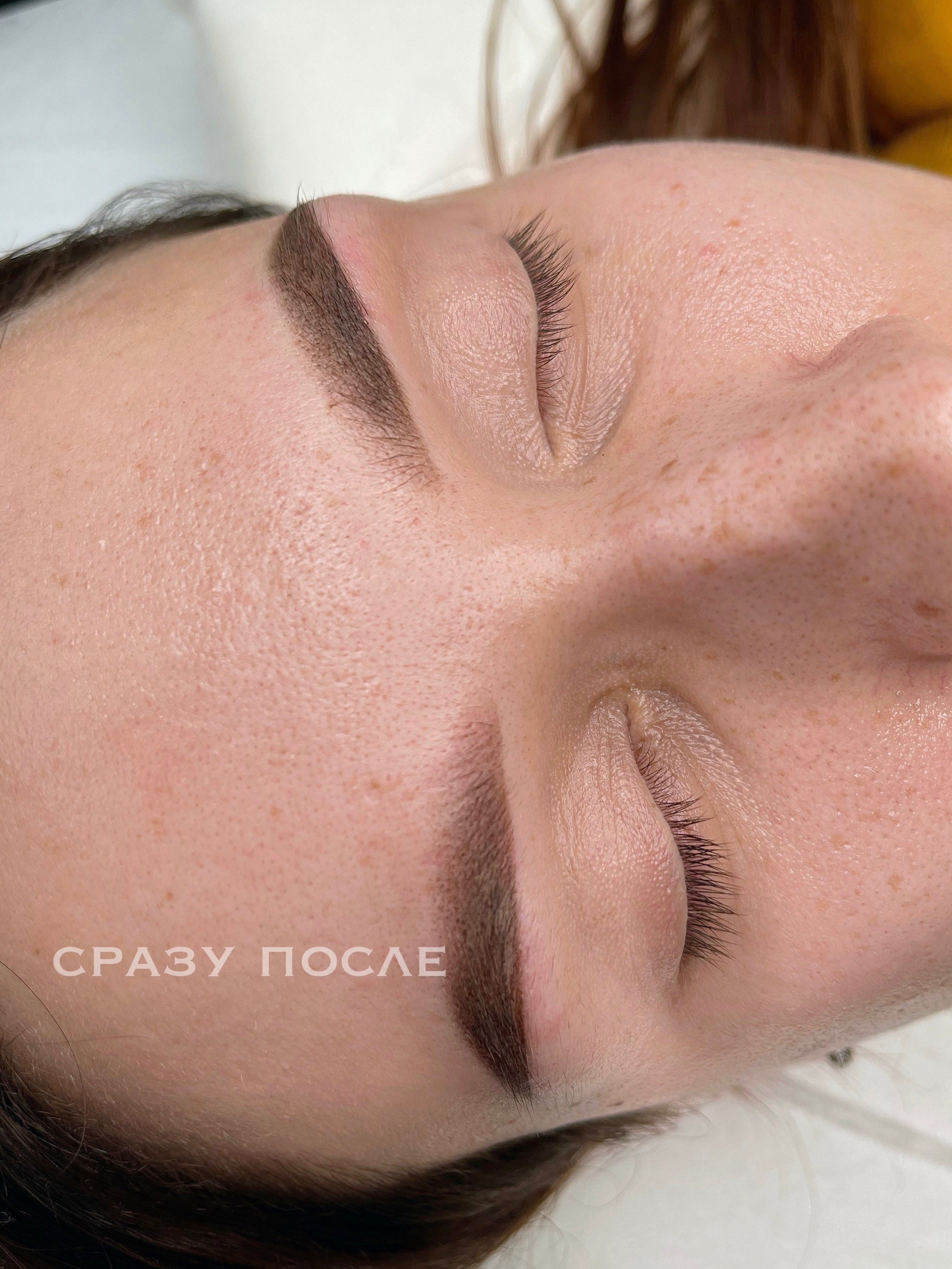 БРОВИ сразу после процедуры. Перманентный макияж и удаление старого татуажа в Ростове-на-Дону Дарья Исакова