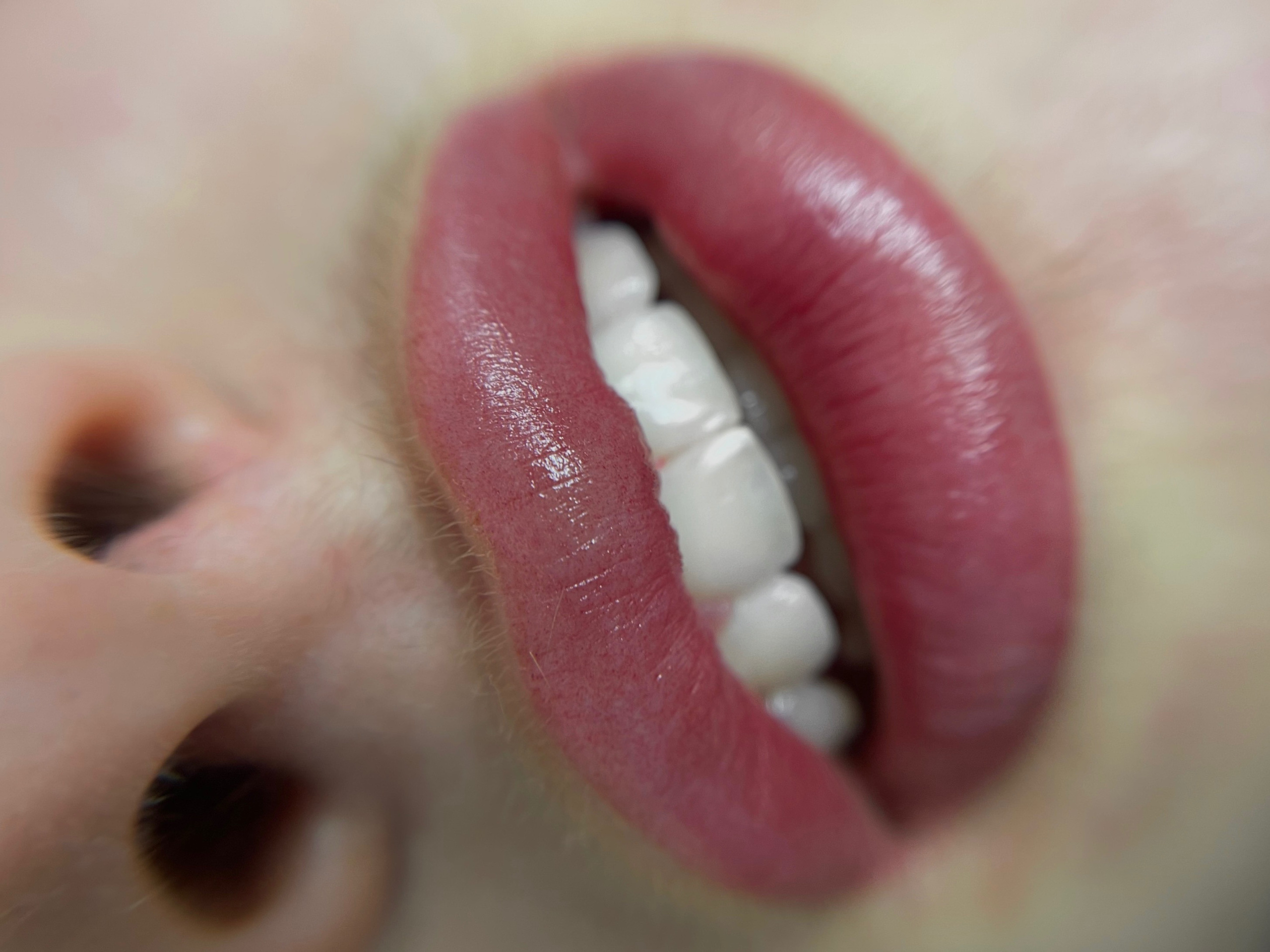 ГУБЫ сразу после процедуры. Перманентный макияж и удаление старого татуажа в Ростове-на-Дону Дарья Исакова