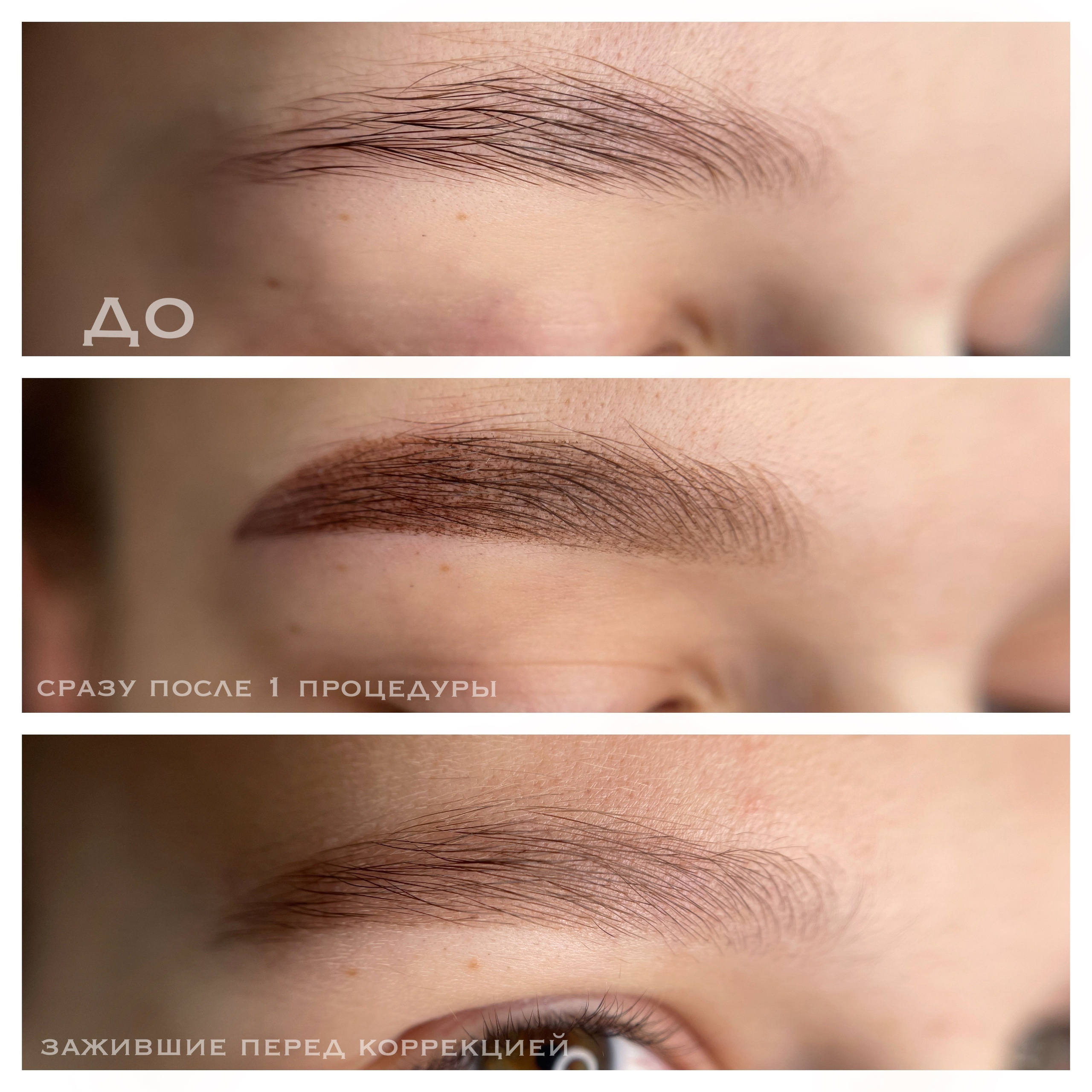 Как заживает перманент 