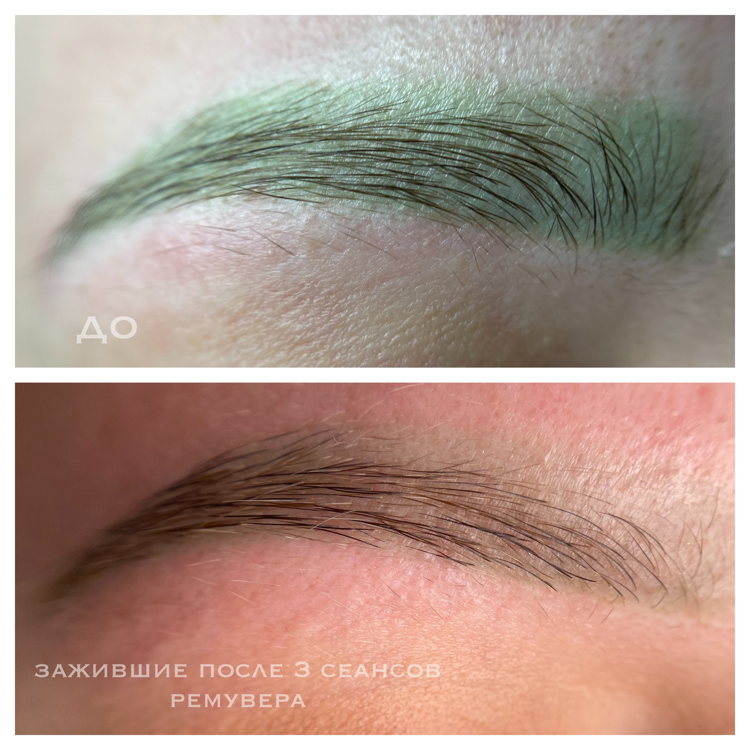 УДАЛЕНИЕ СТАРОГО ТАТУАЖА. Перманентный макияж и удаление старого татуажа в Ростове-на-Дону Дарья Исакова