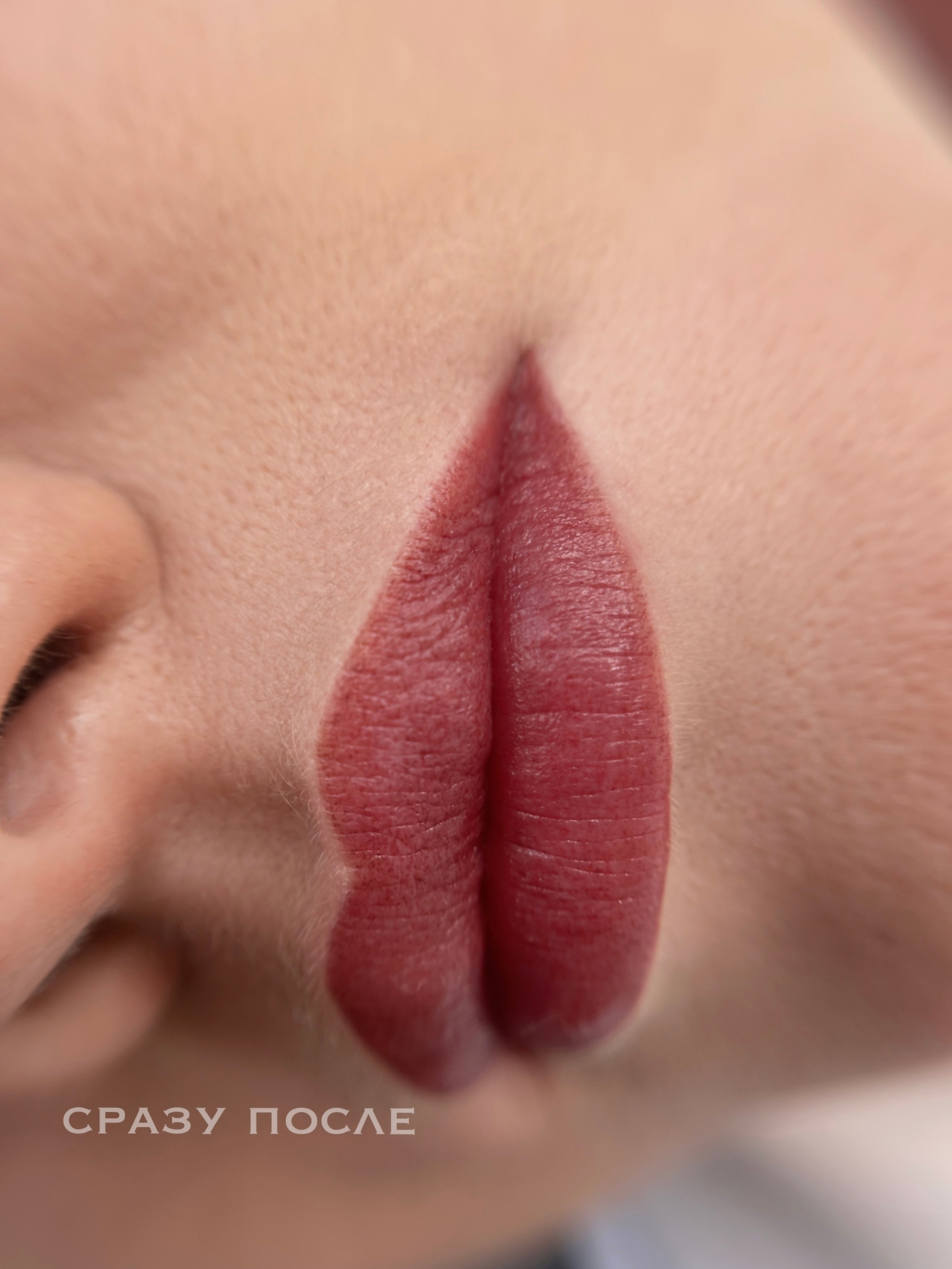 ГУБЫ сразу после процедуры. Перманентный макияж и удаление старого татуажа в Ростове-на-Дону Дарья Исакова