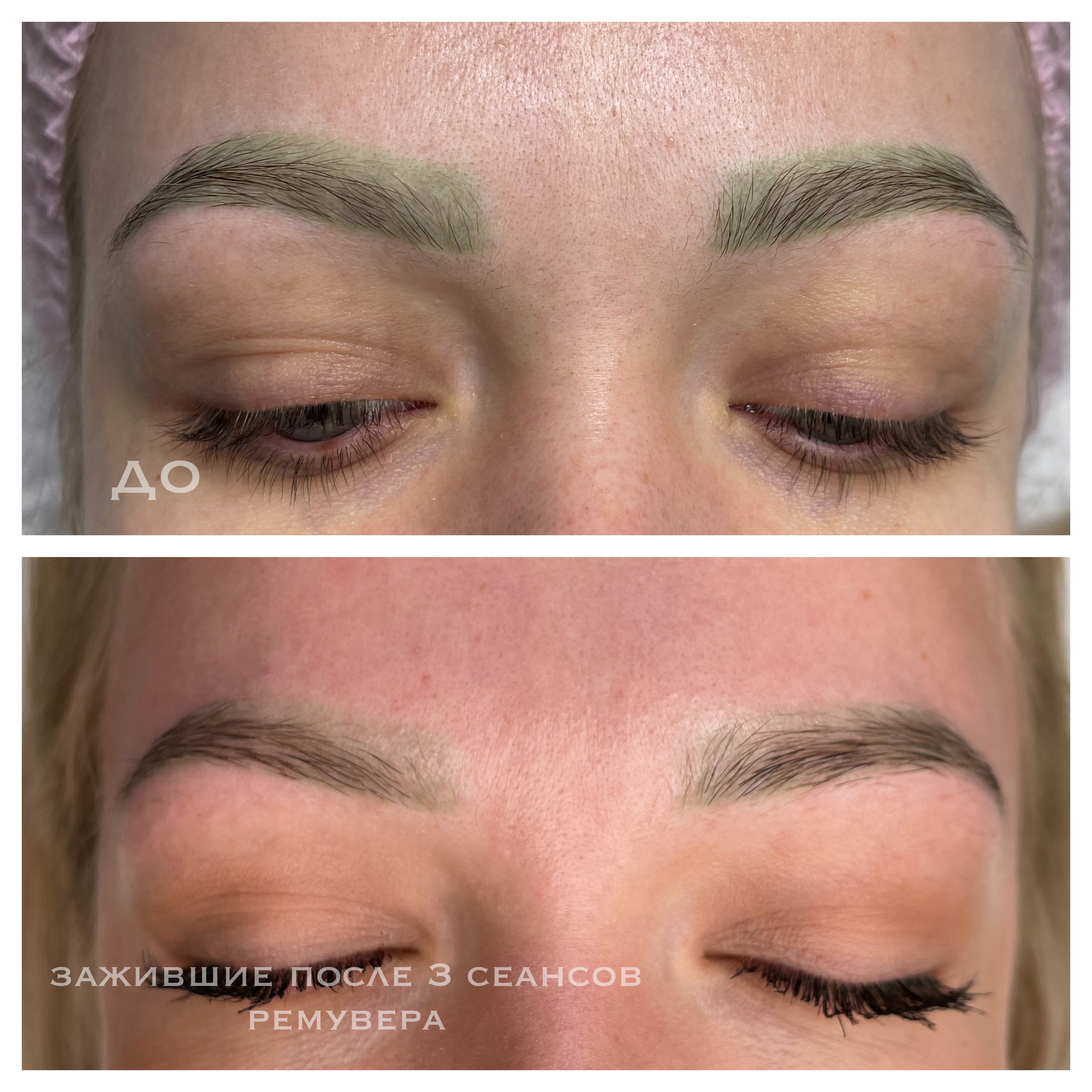 УДАЛЕНИЕ СТАРОГО ТАТУАЖА. Перманентный макияж и удаление старого татуажа в Ростове-на-Дону Дарья Исакова