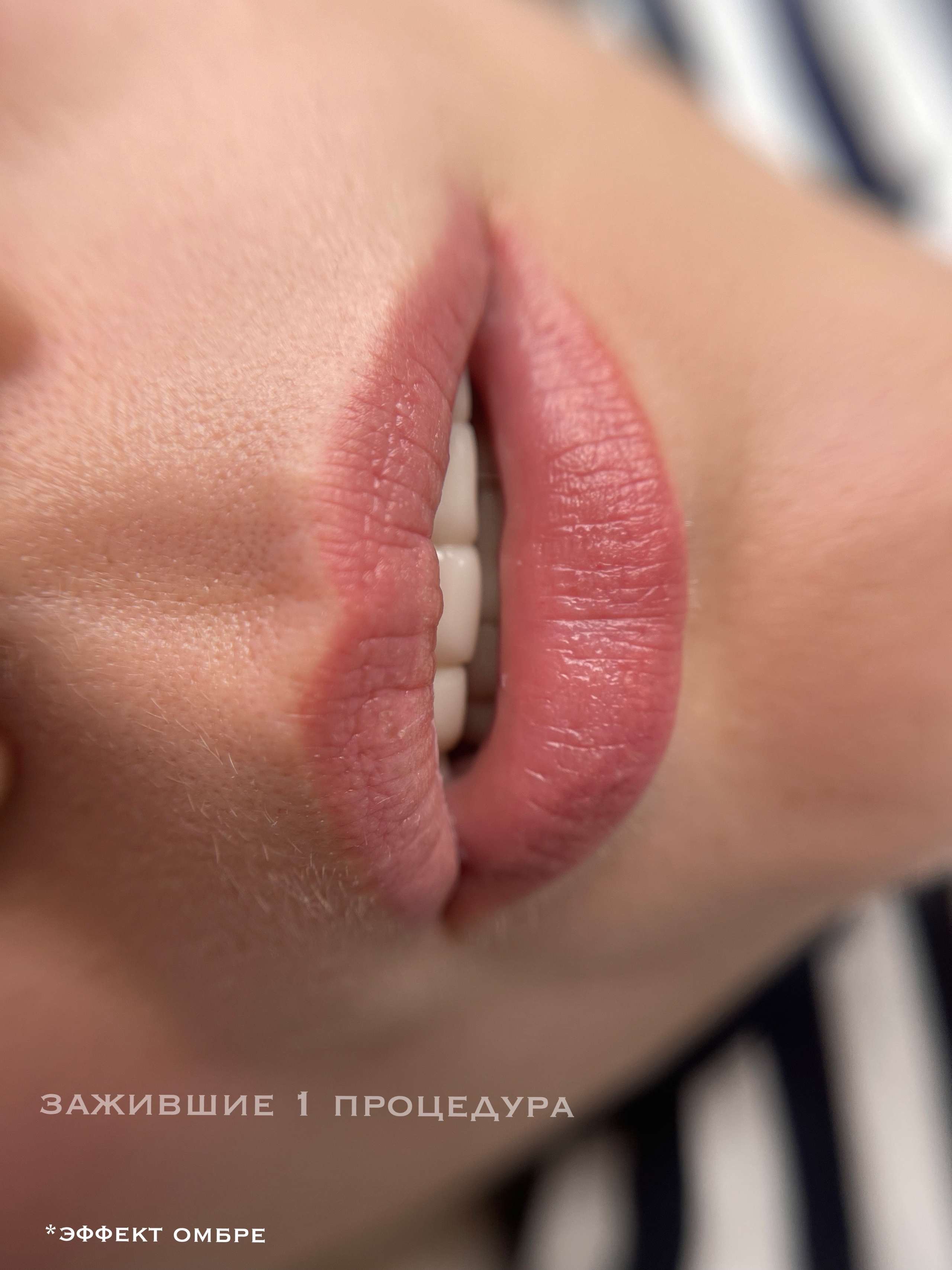 ГУБЫ зажившие. Перманентный макияж и удаление старого татуажа в Ростове-на-Дону Дарья Исакова