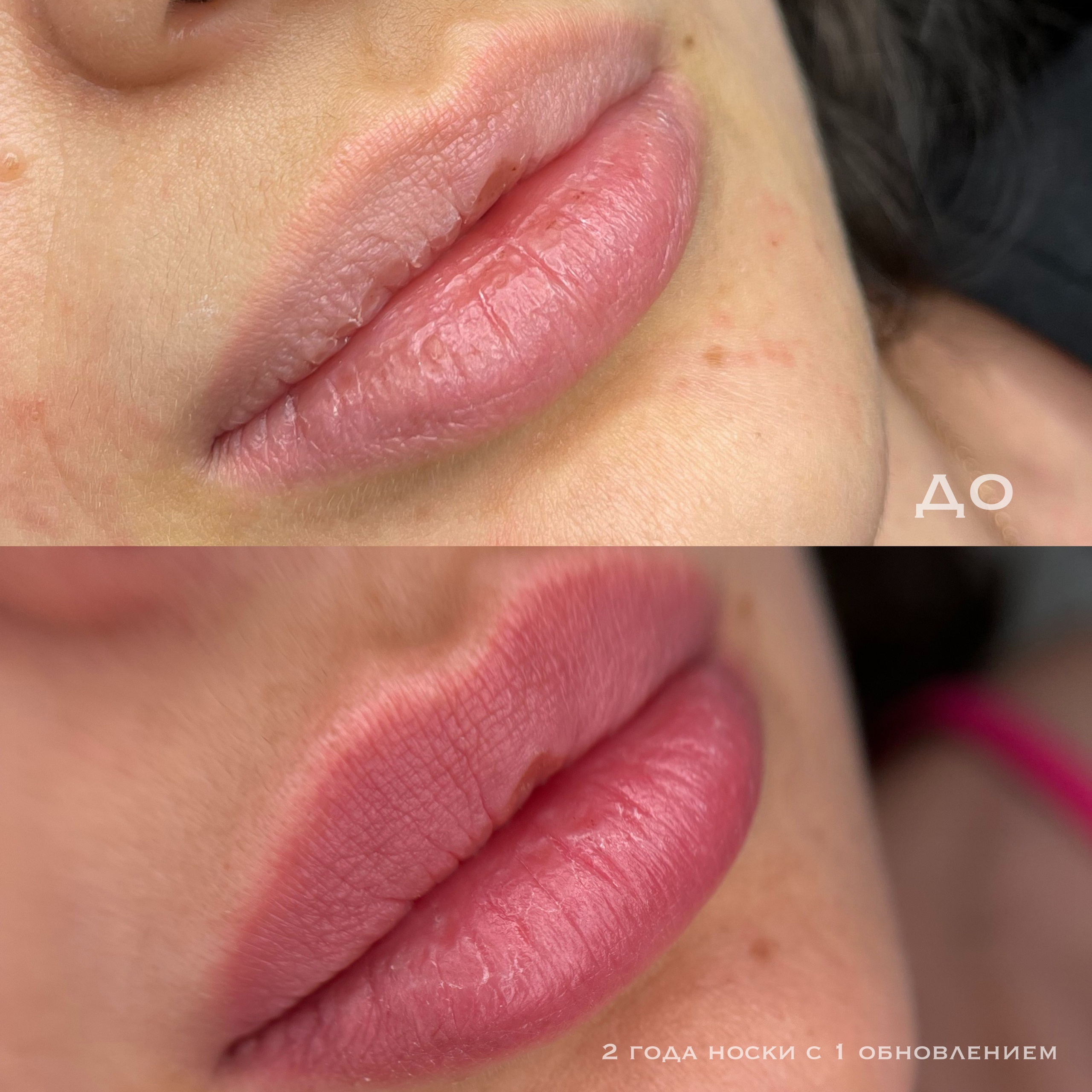 ГУБЫ зажившие. Перманентный макияж и удаление старого татуажа в Ростове-на-Дону Дарья Исакова