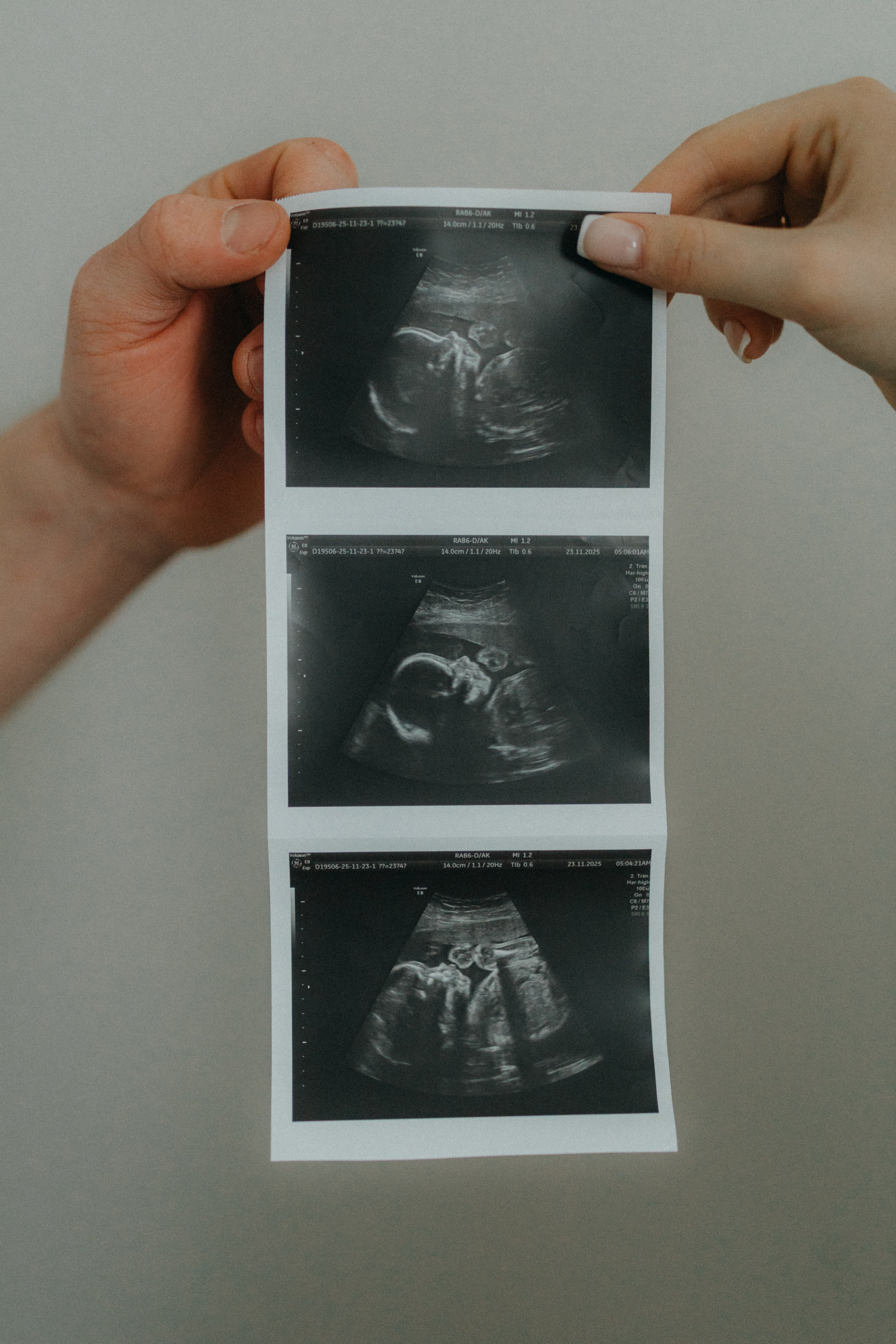 Лиза & Даня.Беременность. Фотограф НОГИНСК, Москва, Анастасия Белая