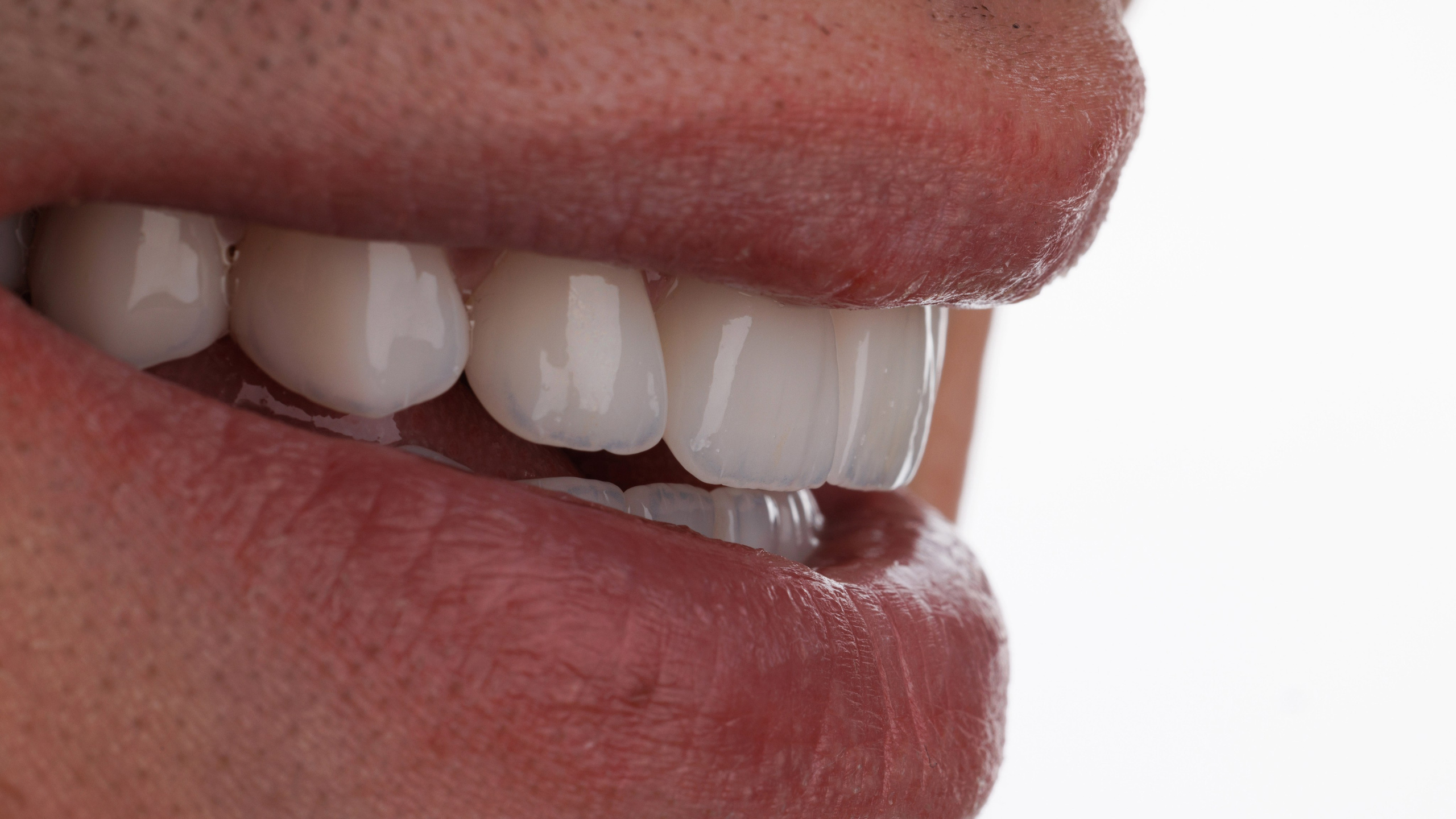 Ортопедия. Дентал фотограф — видеограф Денис Дорошенко