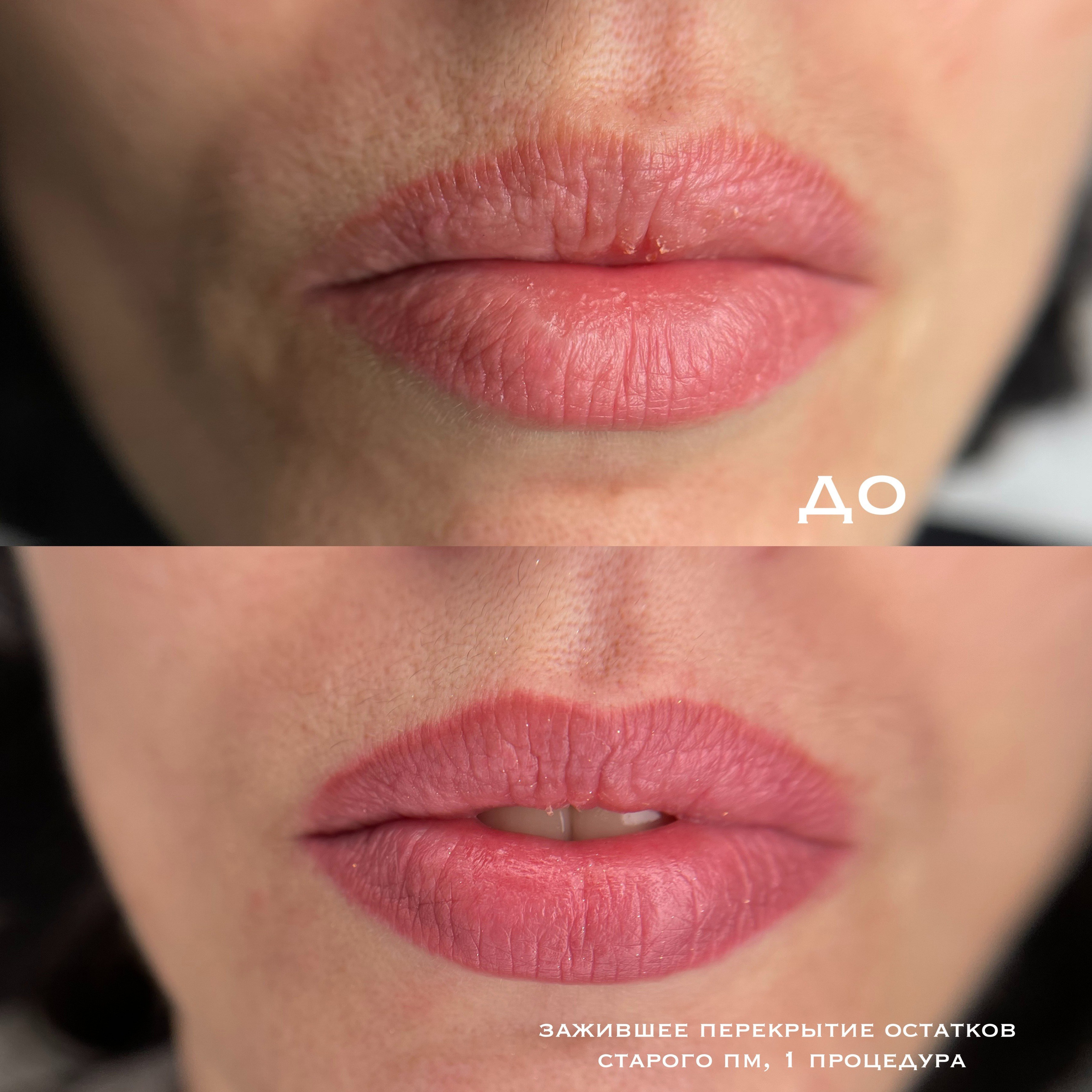 ГУБЫ зажившие. Перманентный макияж и удаление старого татуажа в Ростове-на-Дону Дарья Исакова