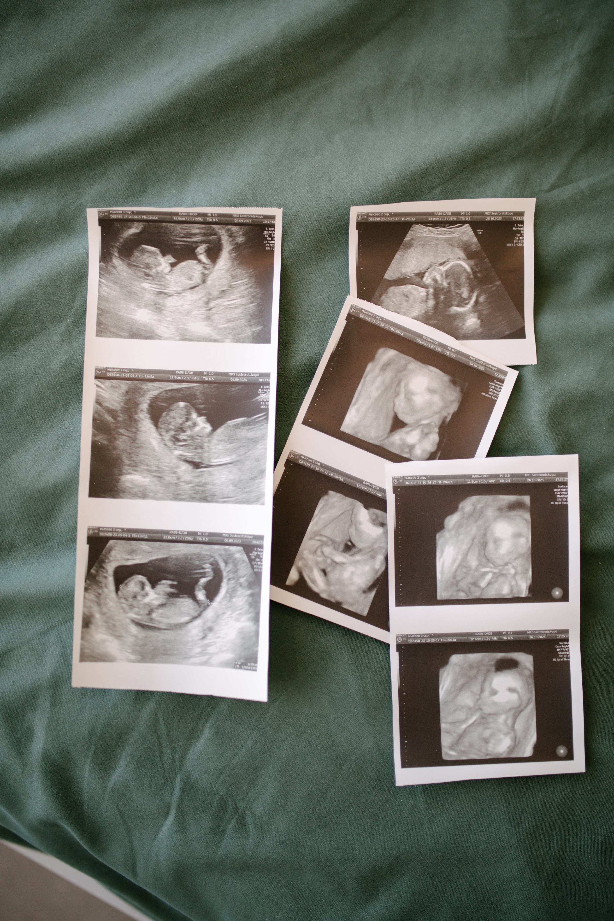 Беременная съемка. Свадебный и семейный фотограф в Санкт-Петербурге Исупова Юлия