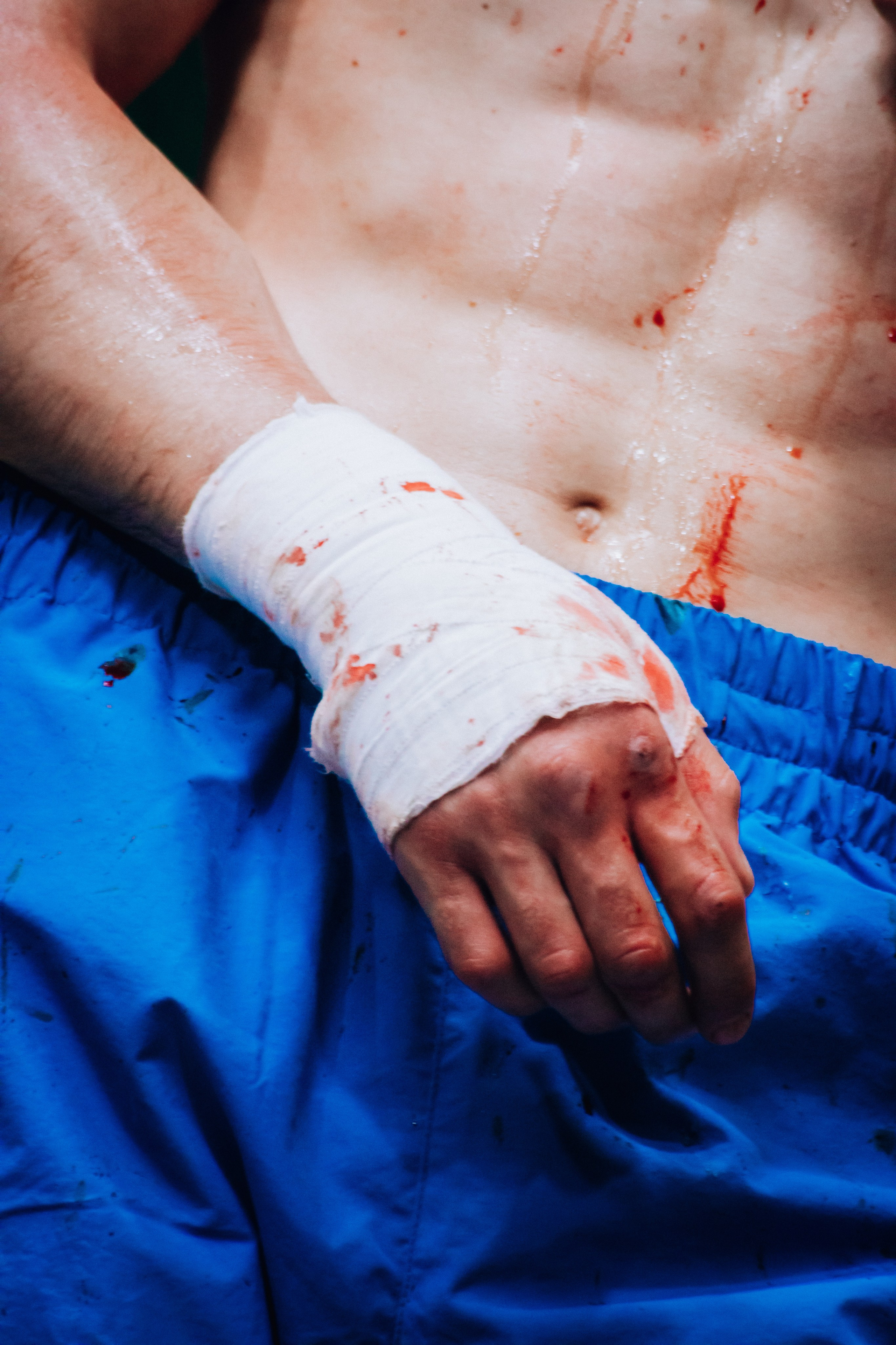 Кулачные бои TopDog. Анастасия Тен