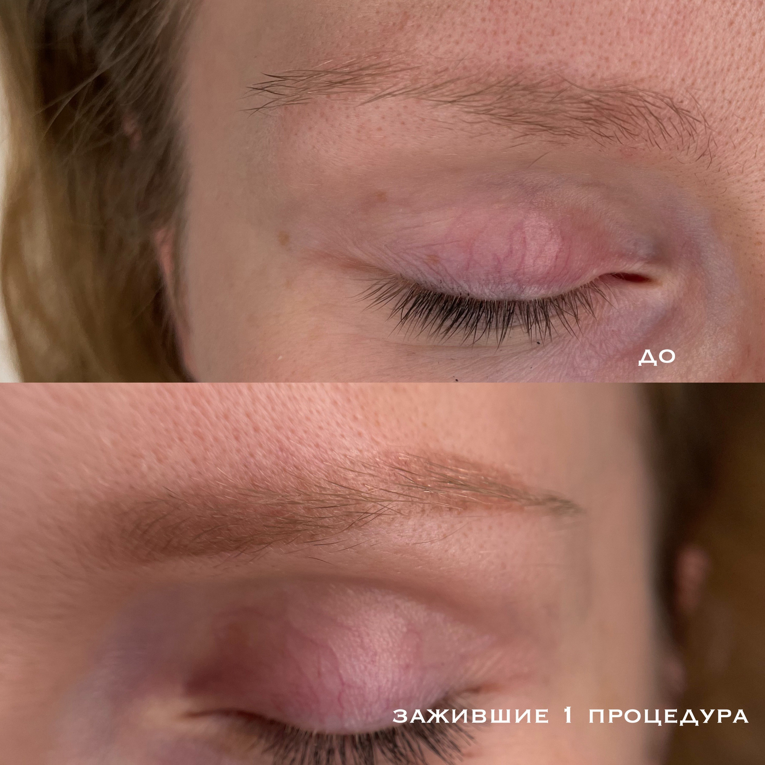 БРОВИ зажившие. Перманентный макияж и удаление старого татуажа в Ростове-на-Дону Дарья Исакова