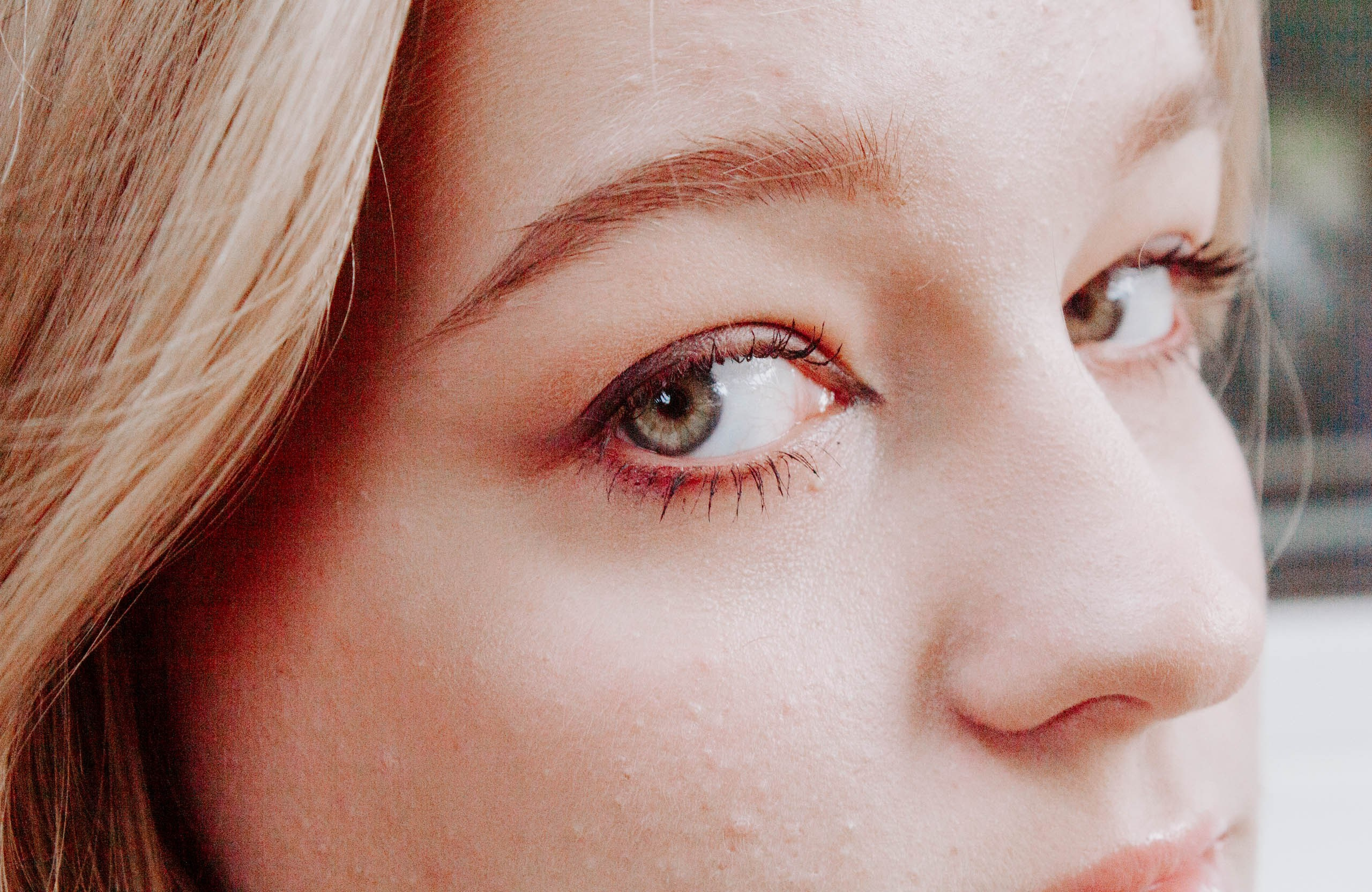 Ромашки веснушки мы лучшие подружки