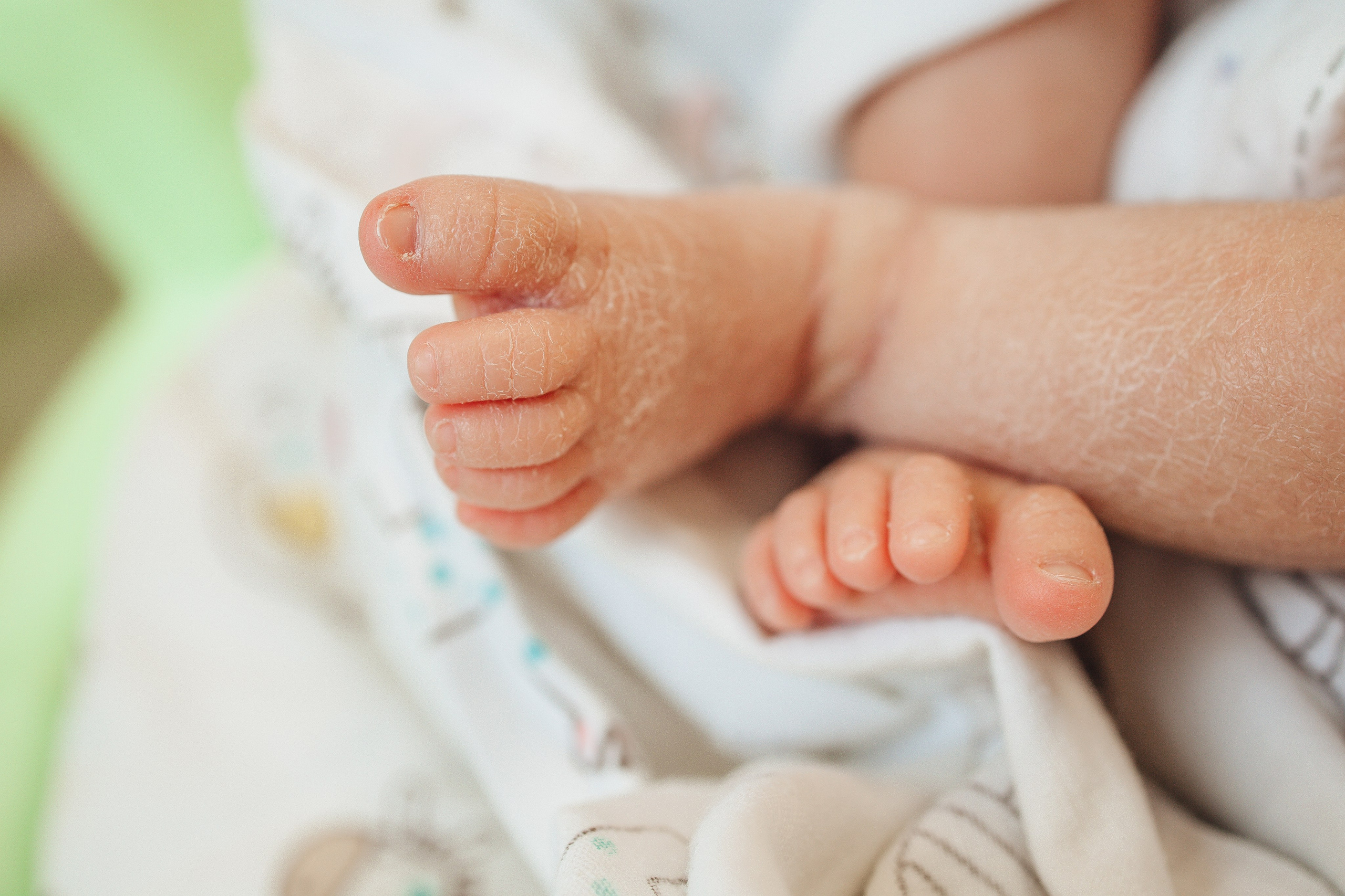 МАЛЫШИ в палате. МиМика — самая детская фотография