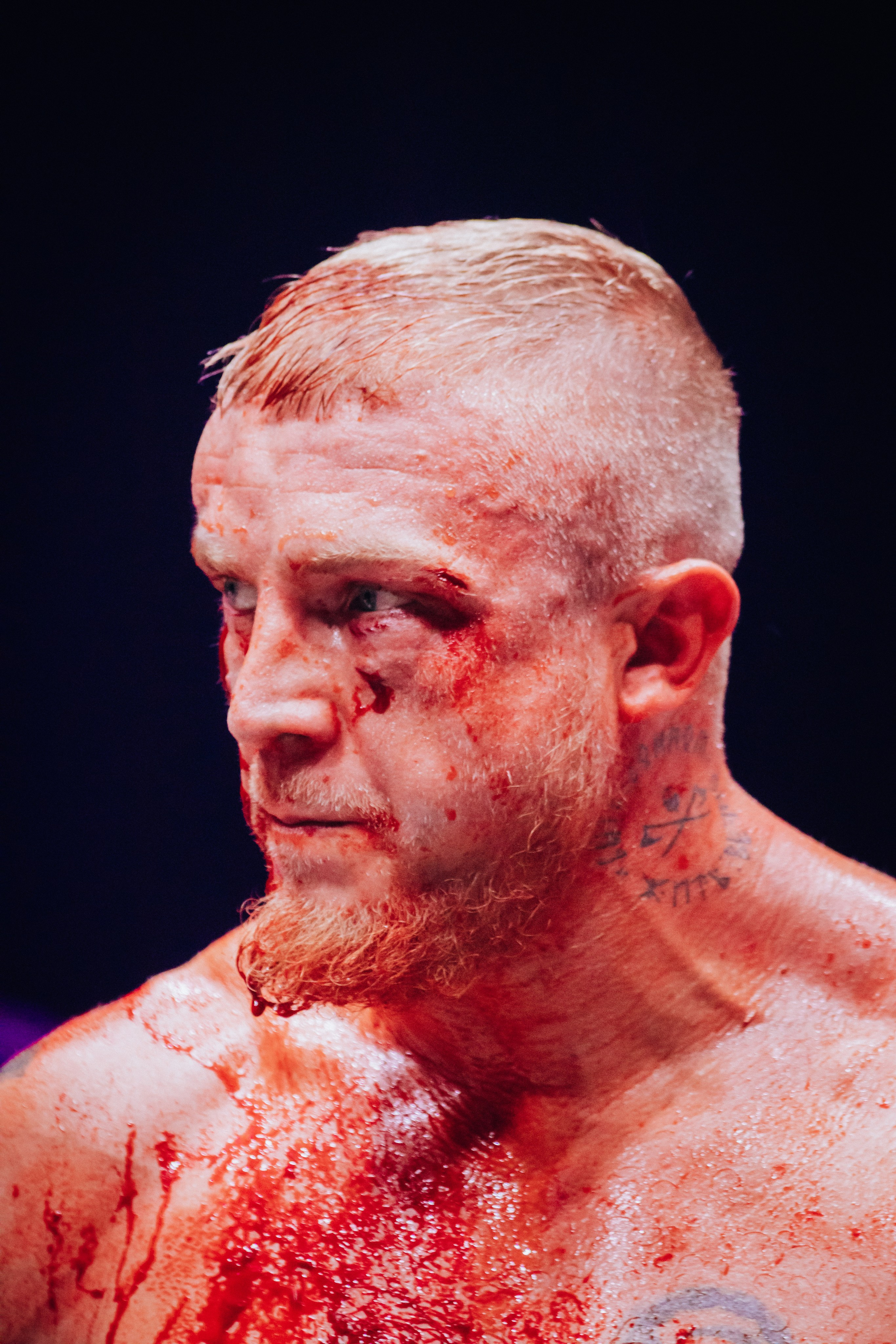 Кулачные бои TopDog. Анастасия Тен