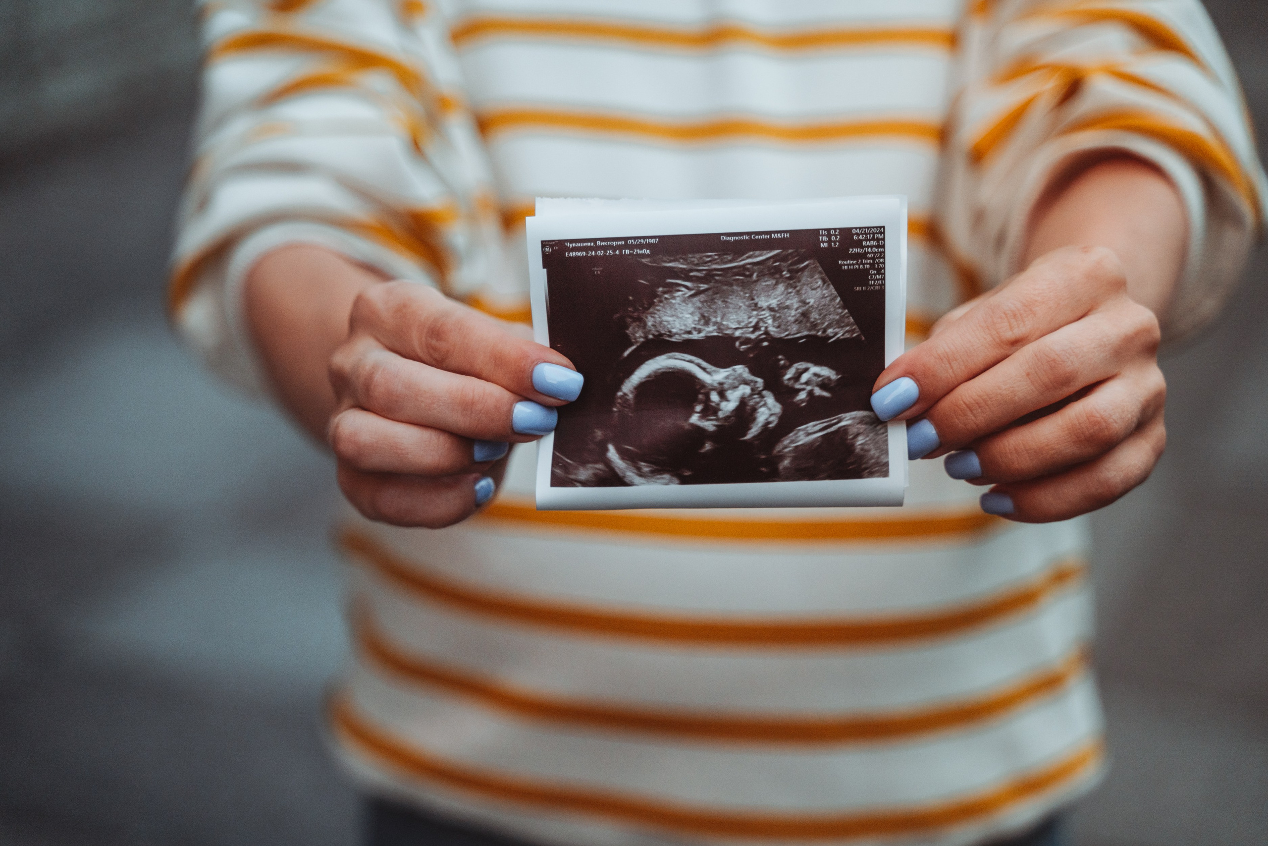 Фотограф беременности Санкт-Петербург. Свадебный, семейный, портретный, репортажный фотограф в Санкт-Петербурге