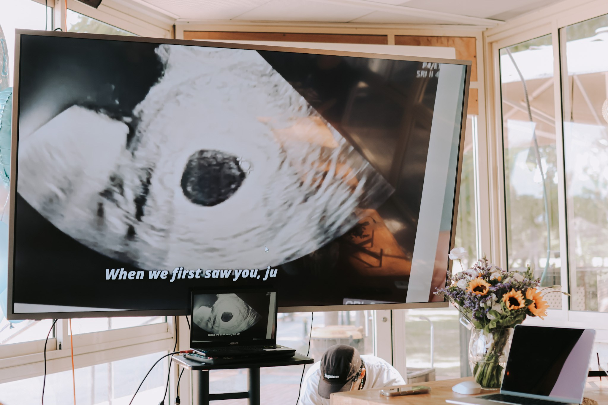 Brit Mila celebration, Ramat Gan | October 2025. Photographer in Israel Alice Milchin