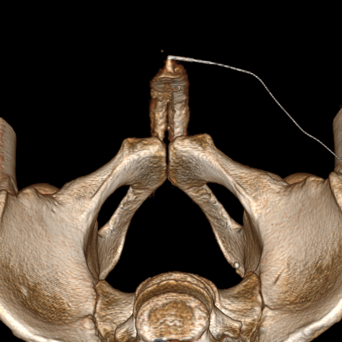 ЭРЕКТИЛЬНАЯ ДИСФУНКЦИЯ. РЕНТГЕН КТ МРТ в Санкт-Петербурге Александра Лоншакова