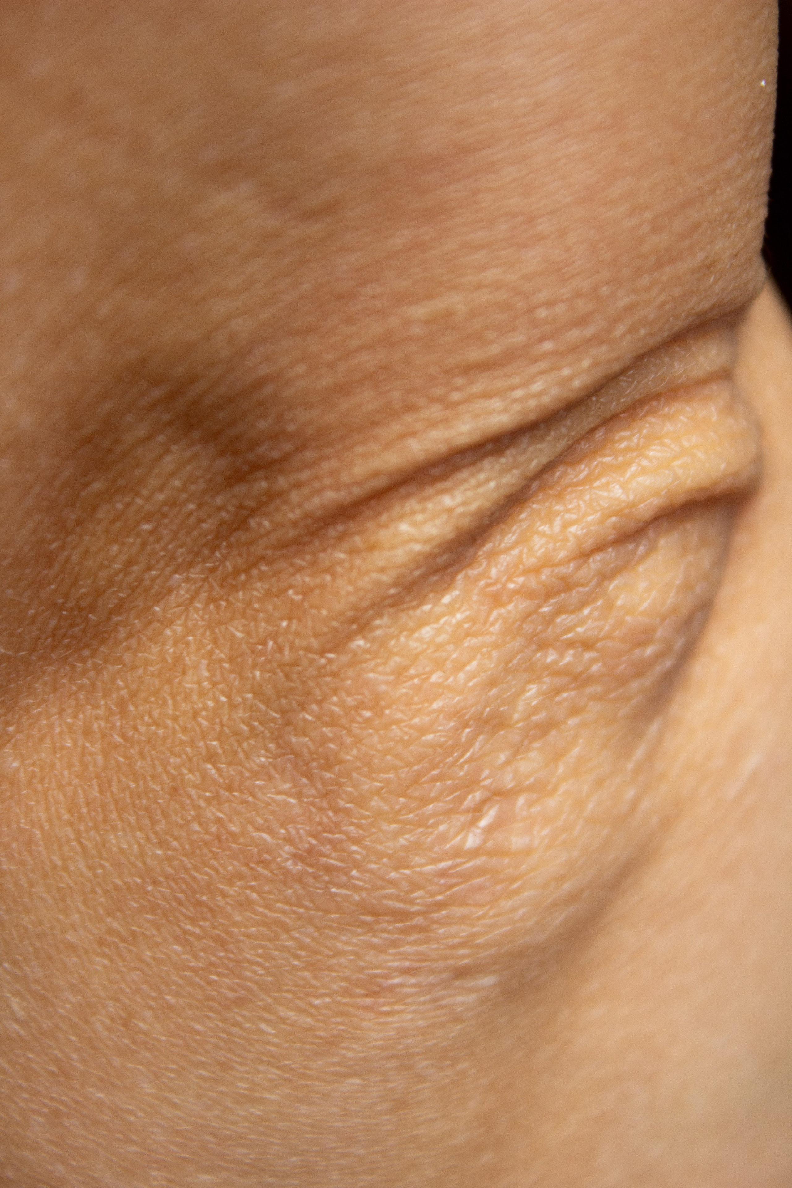 Анатомия трещин (красненькая биеннале, санкт-петербург, 2025). Julia Gorbunova