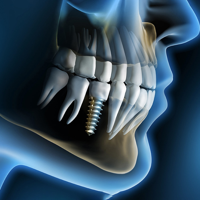 Стоматолог хирург-имплантолог Иванов Андрей Анатольевич