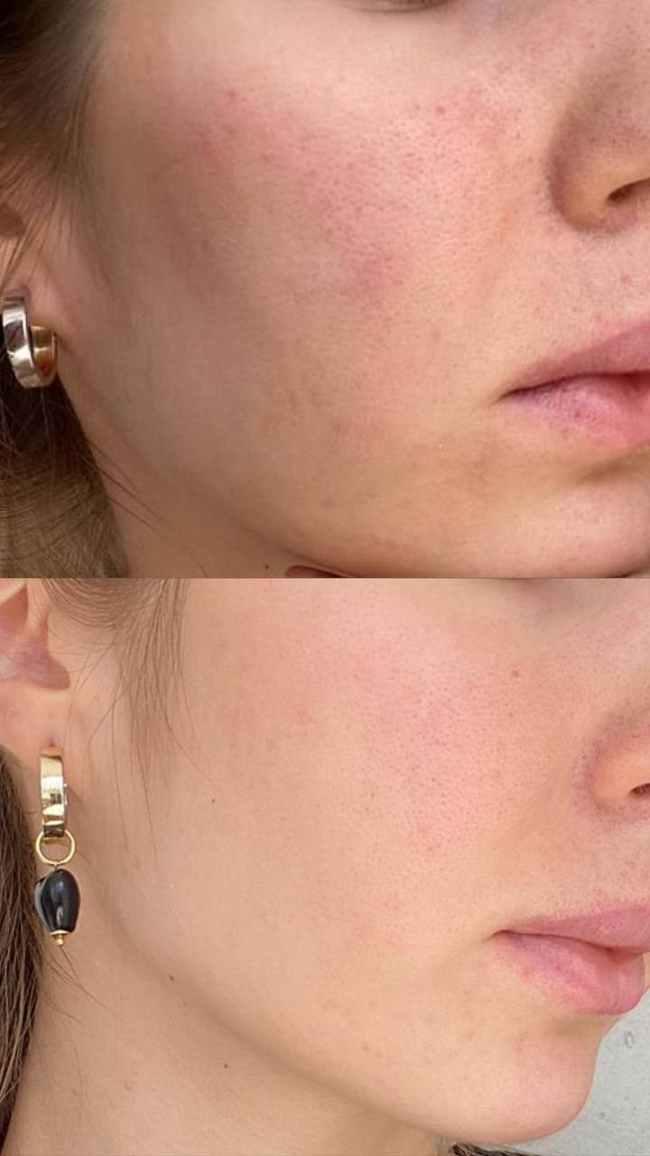 Стоимость услуг. Перманентный макияж и удаление старого татуажа в Ростове-на-Дону Дарья Исакова