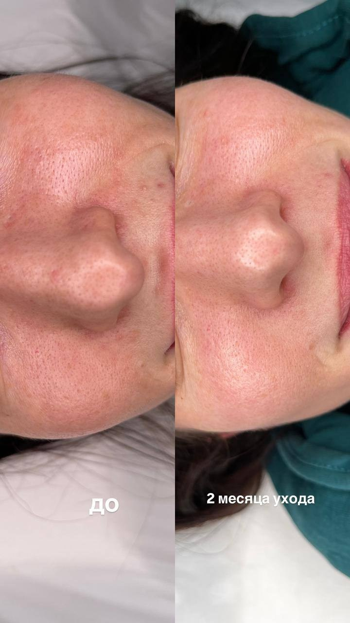 Стоимость услуг. Перманентный макияж и удаление старого татуажа в Ростове-на-Дону Дарья Исакова