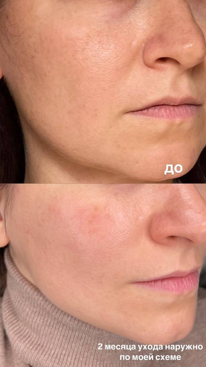 Стоимость услуг. Перманентный макияж и удаление старого татуажа в Ростове-на-Дону Дарья Исакова