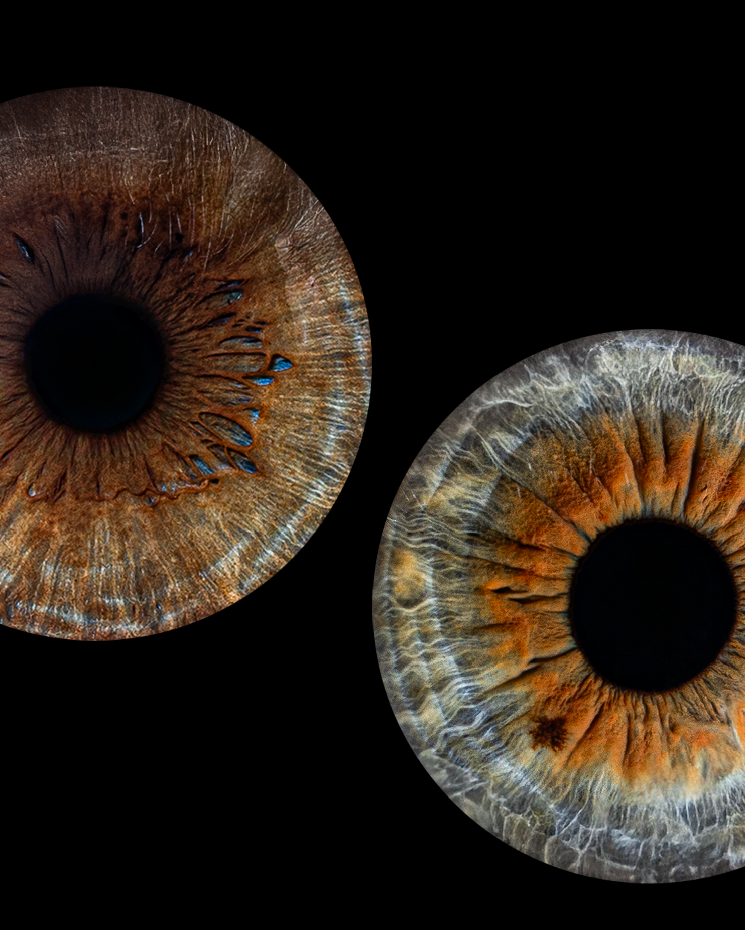 макрофотография радужка глаза в Зеленоградске Макрофотография радужки глаза в Калининградской области.