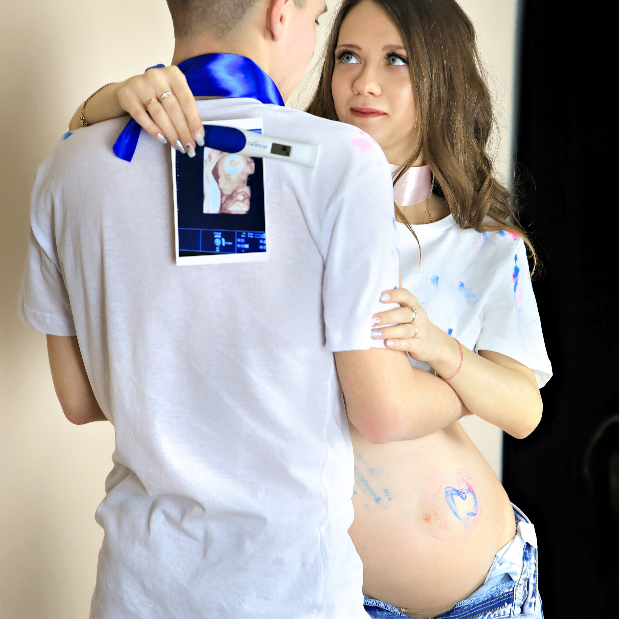 Беременность