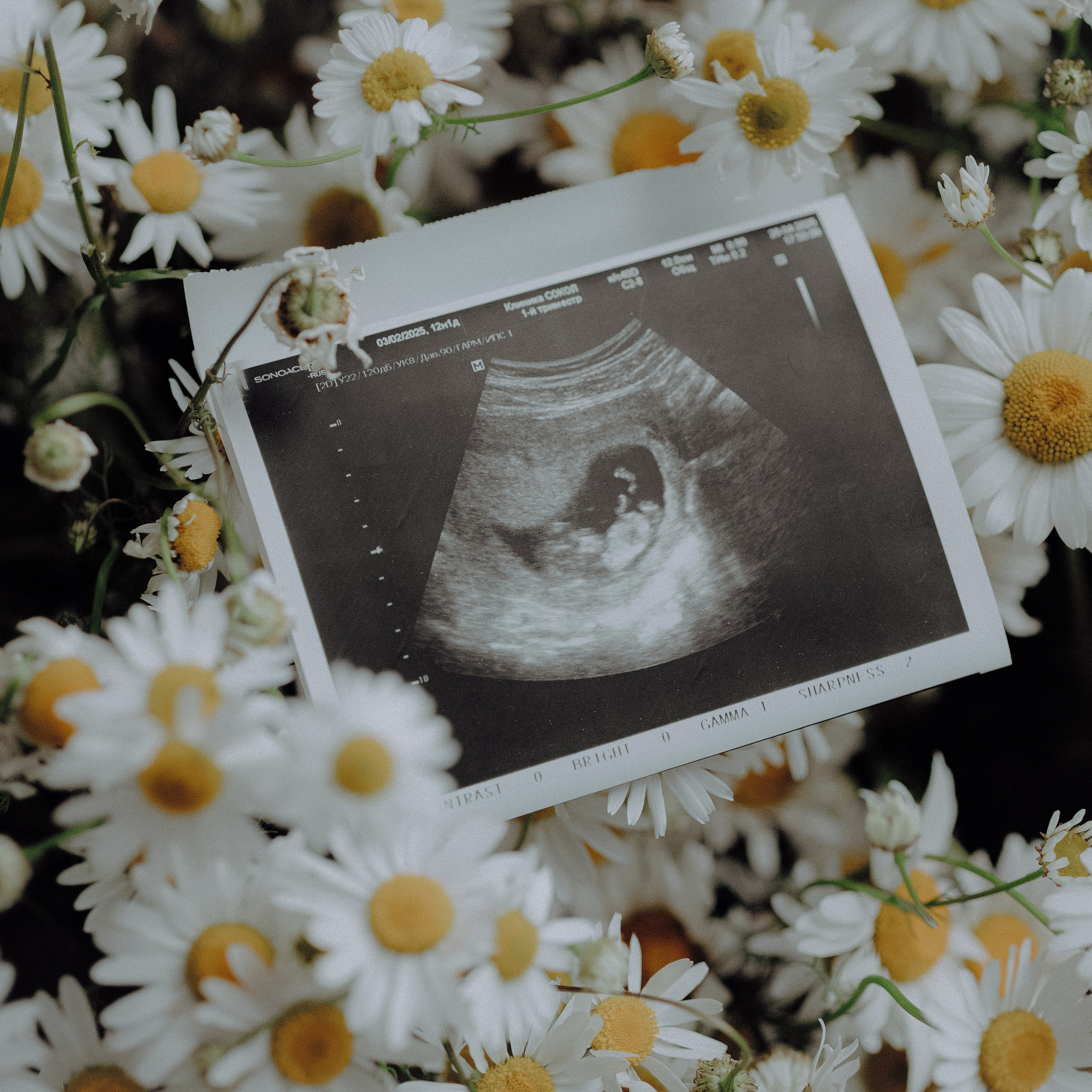 Алексей & Юлия. Фотограф в Москве Валерия Рожкова