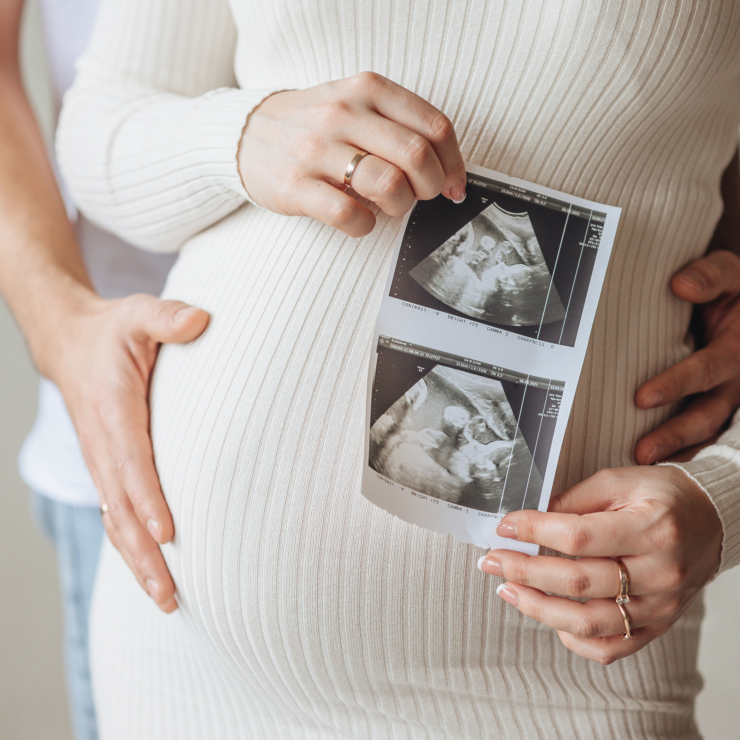 Катя и Артём