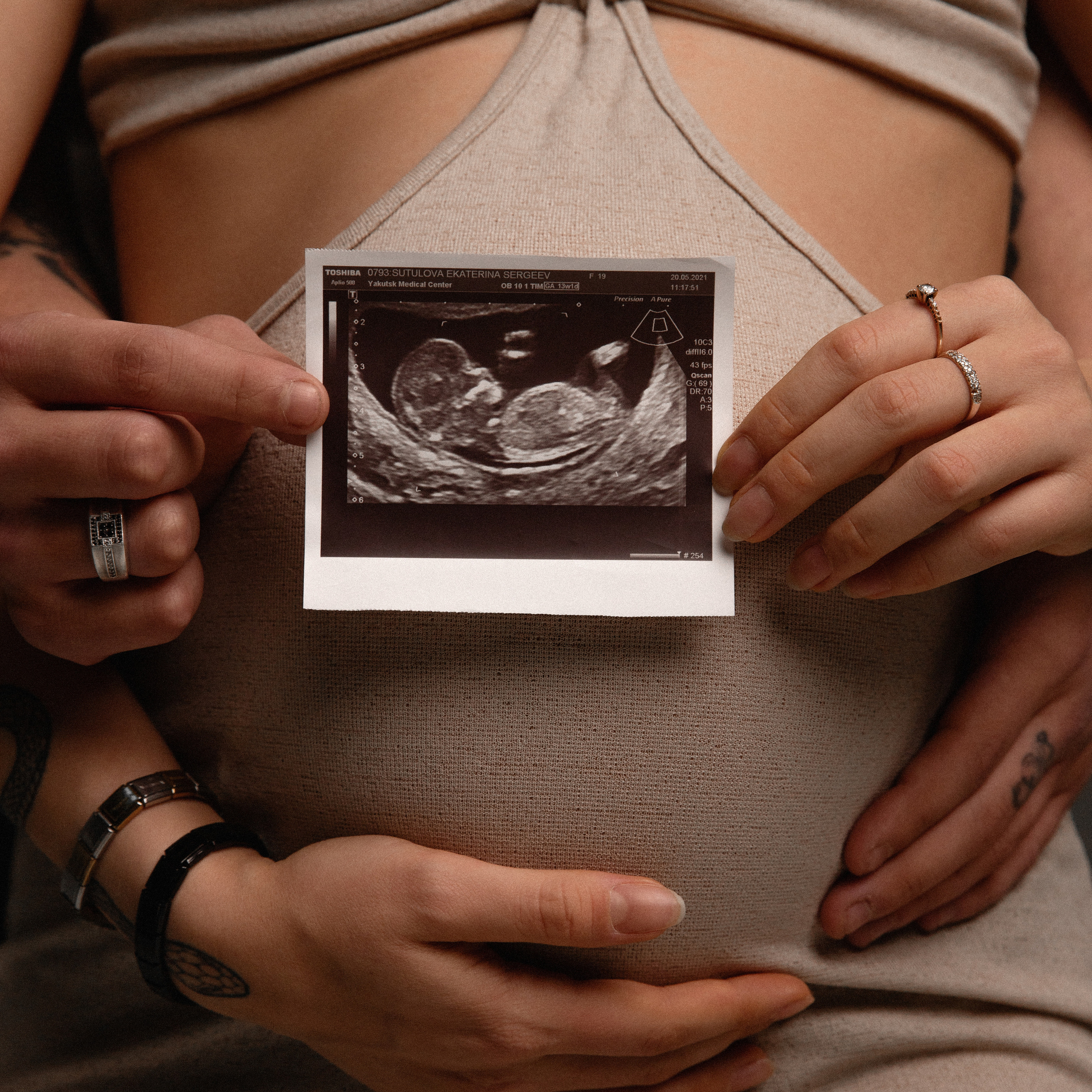 Беременность