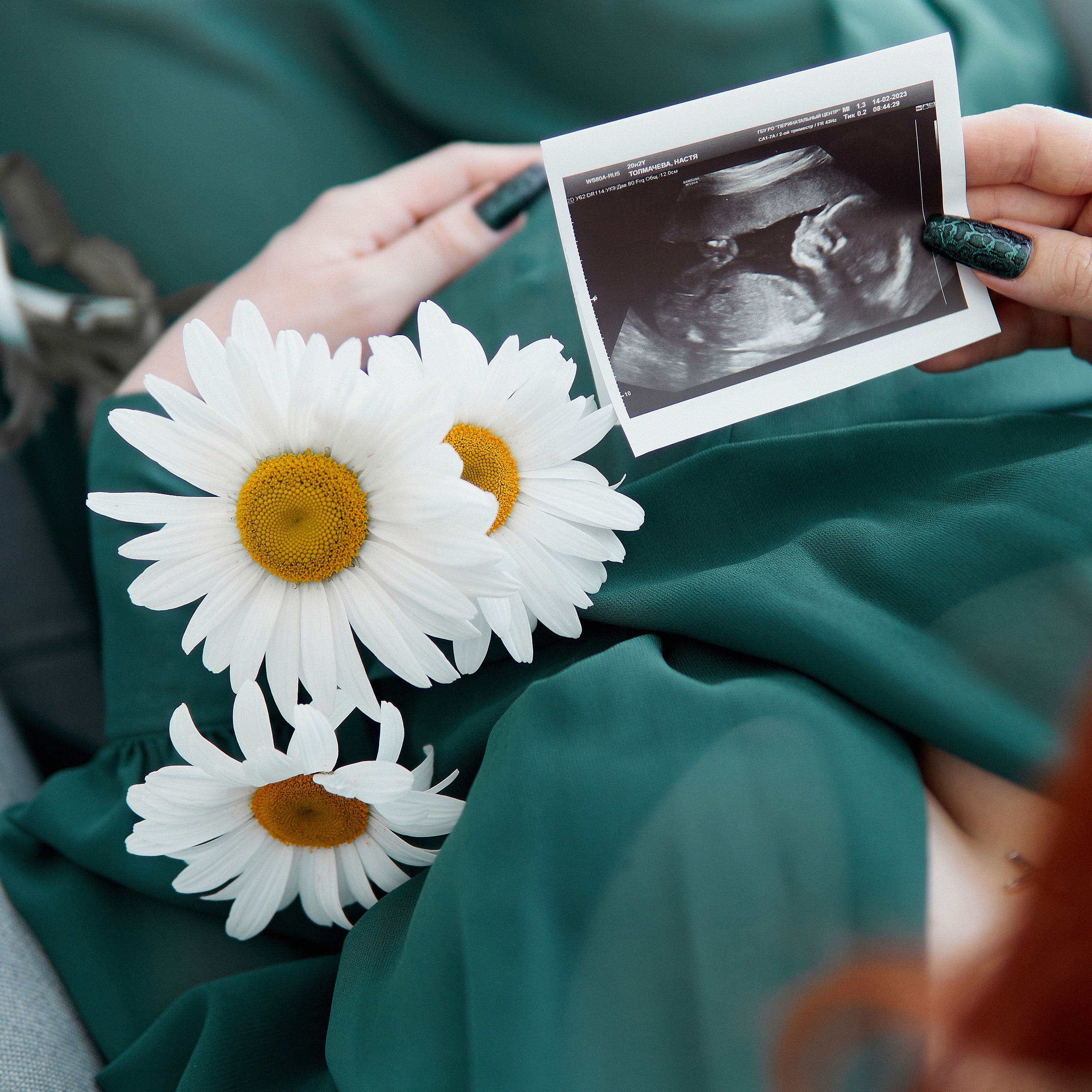 Отзывы. Фотограф Александра Лазарева