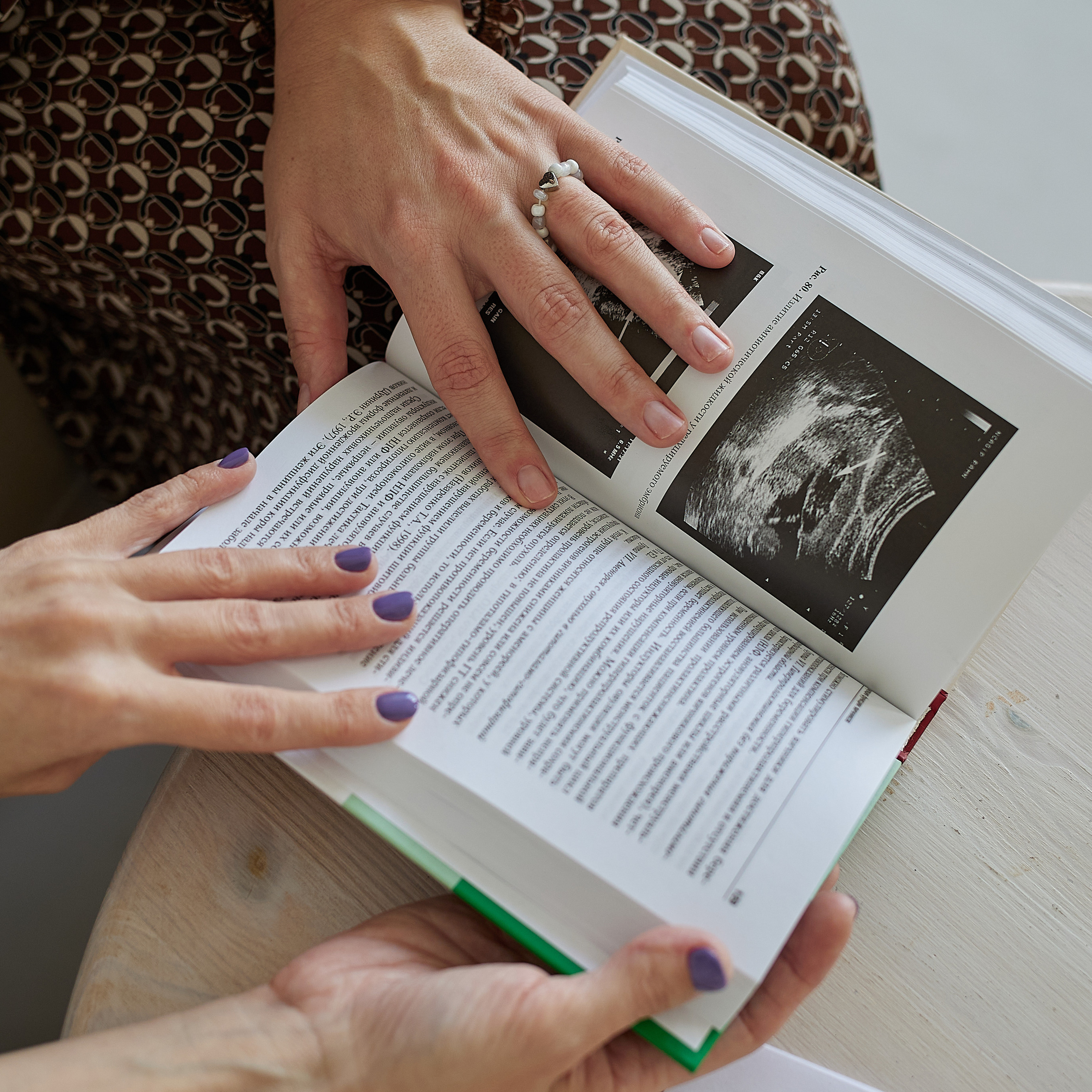 ОТЗЫВЫ. ФОТОГРАФ НОВОРОЖДЕННЫХ ЧЕРЕПОВЕЦ САНКТ-ПЕТЕРБУРГ