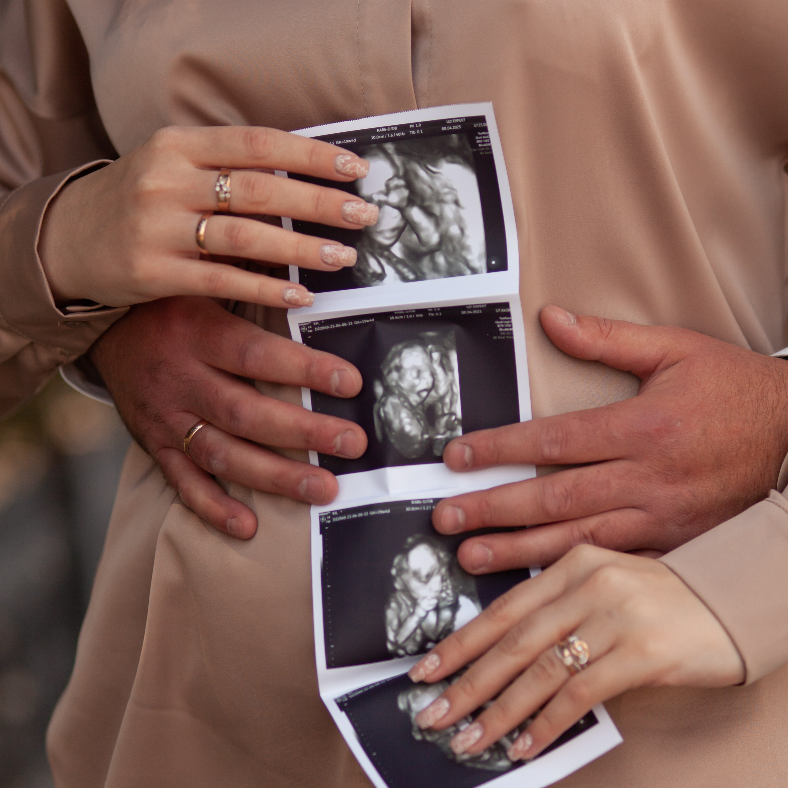 Беременность