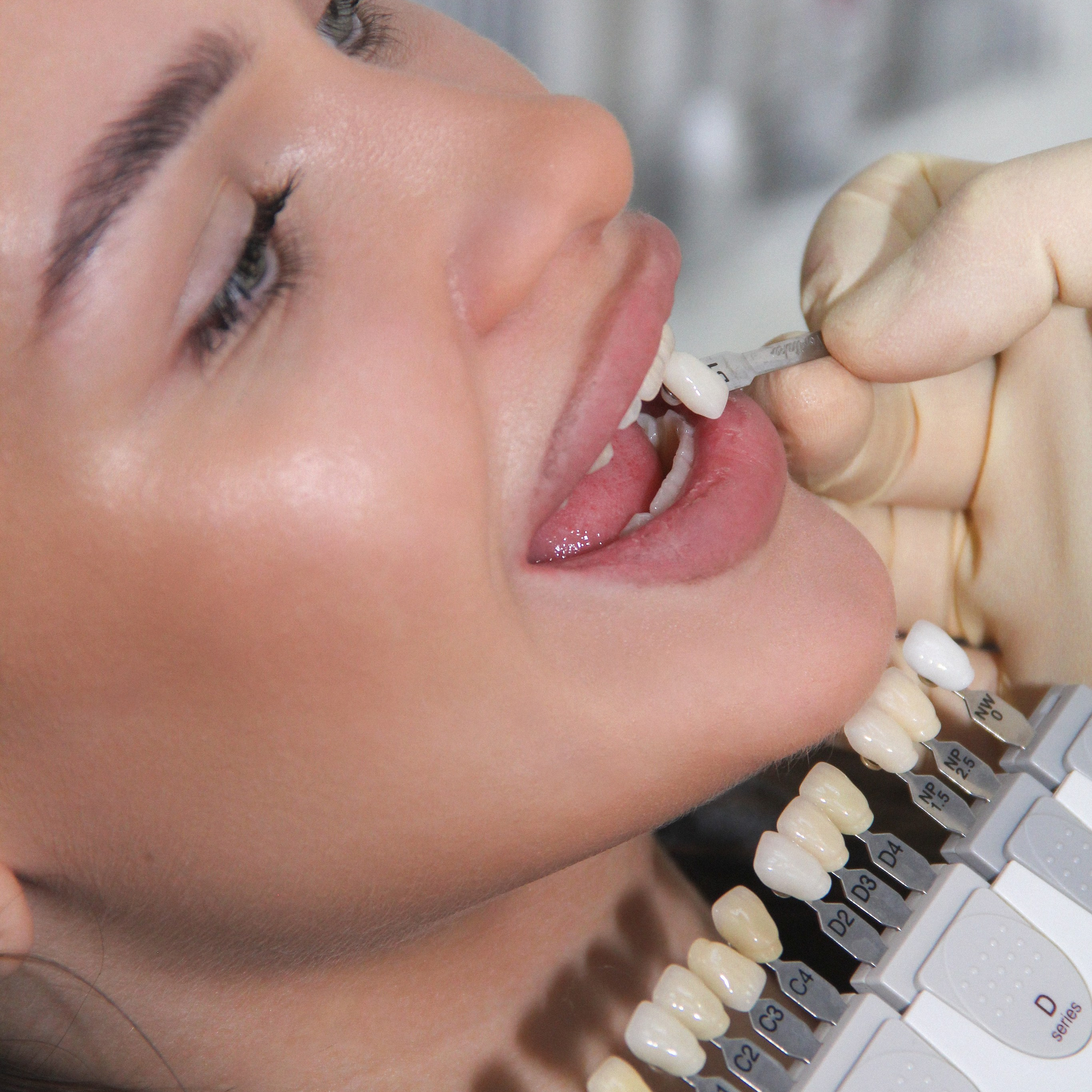 Стоматолог | на фотоаппарат