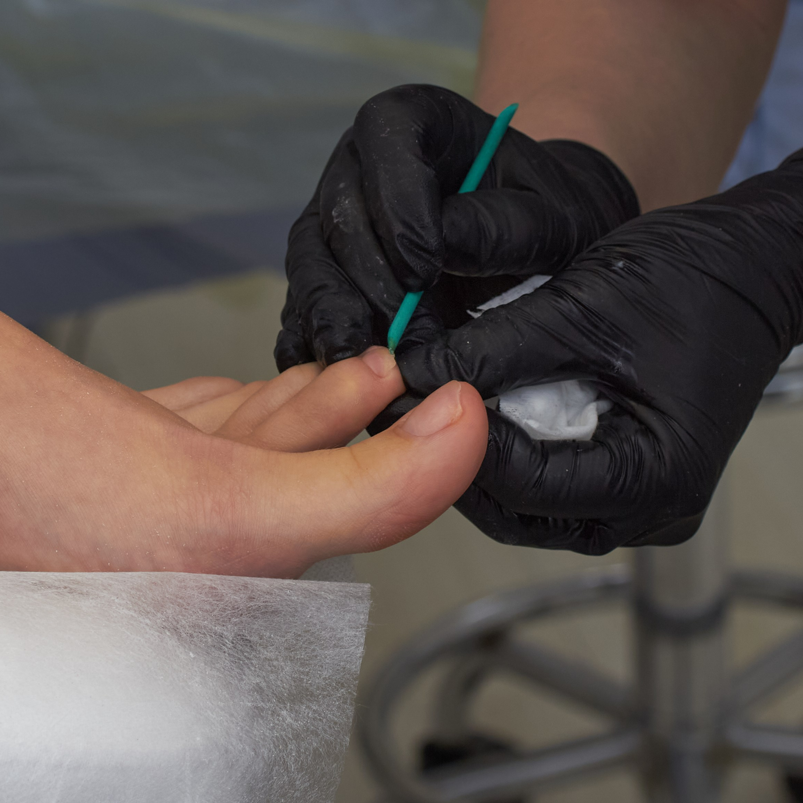 Подолог проводит санацию пальцев клиента