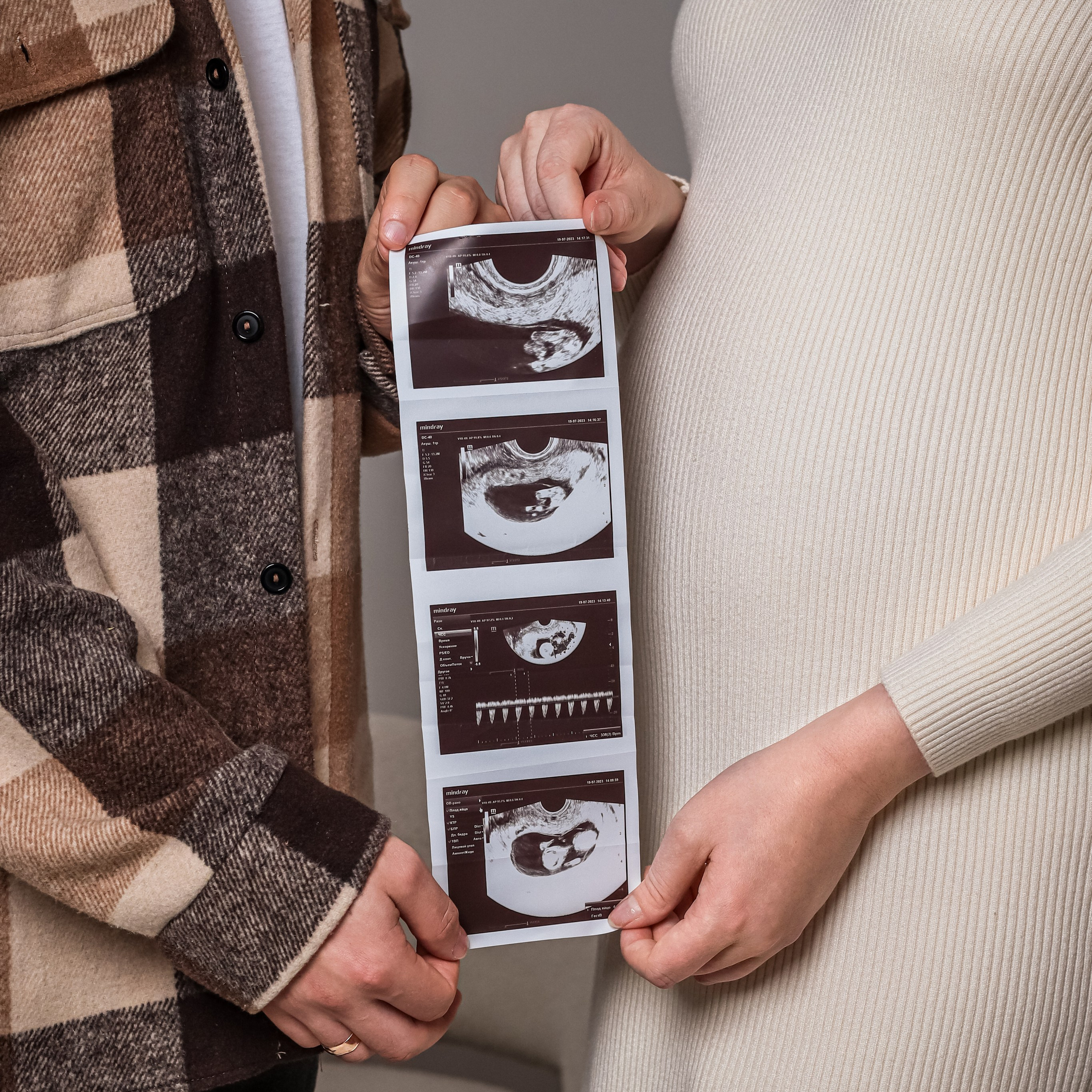 Отзывы. Фотограф Химки Анна Татарских