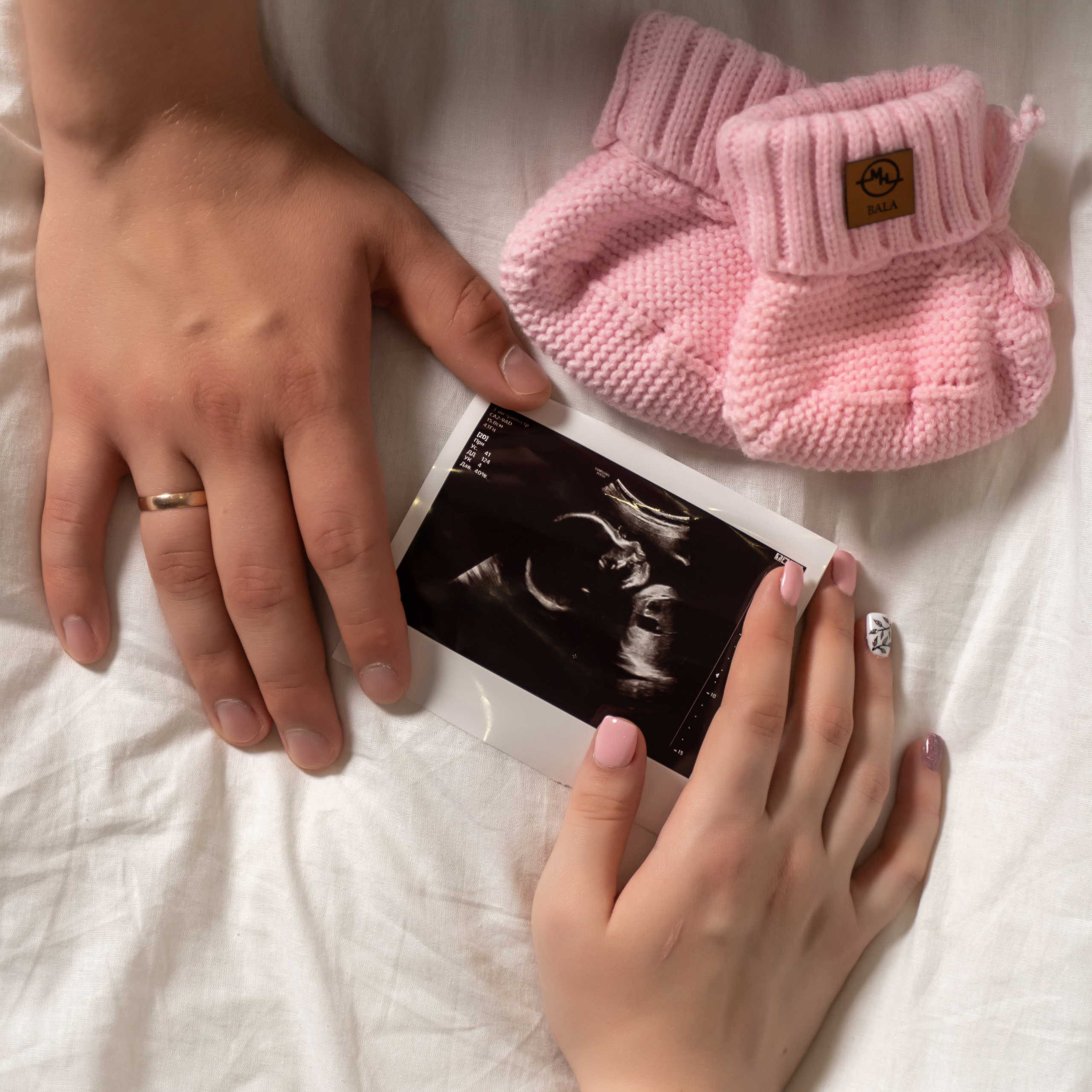 Отзывы от наших клиентов. Череваненко Сергей и Элина — свадебный фотограф видеограф